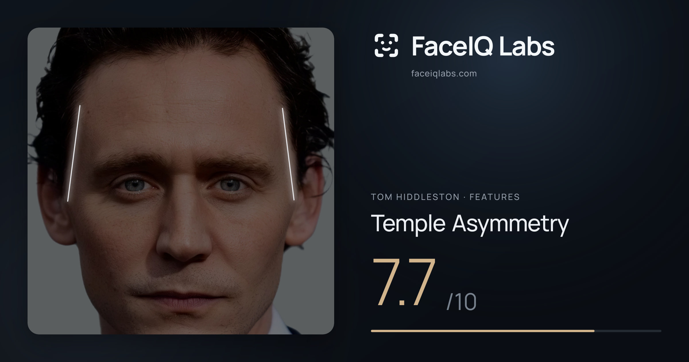 Tom Hiddleston Temple Asymmetry: 7.7/10, drawn on the photo