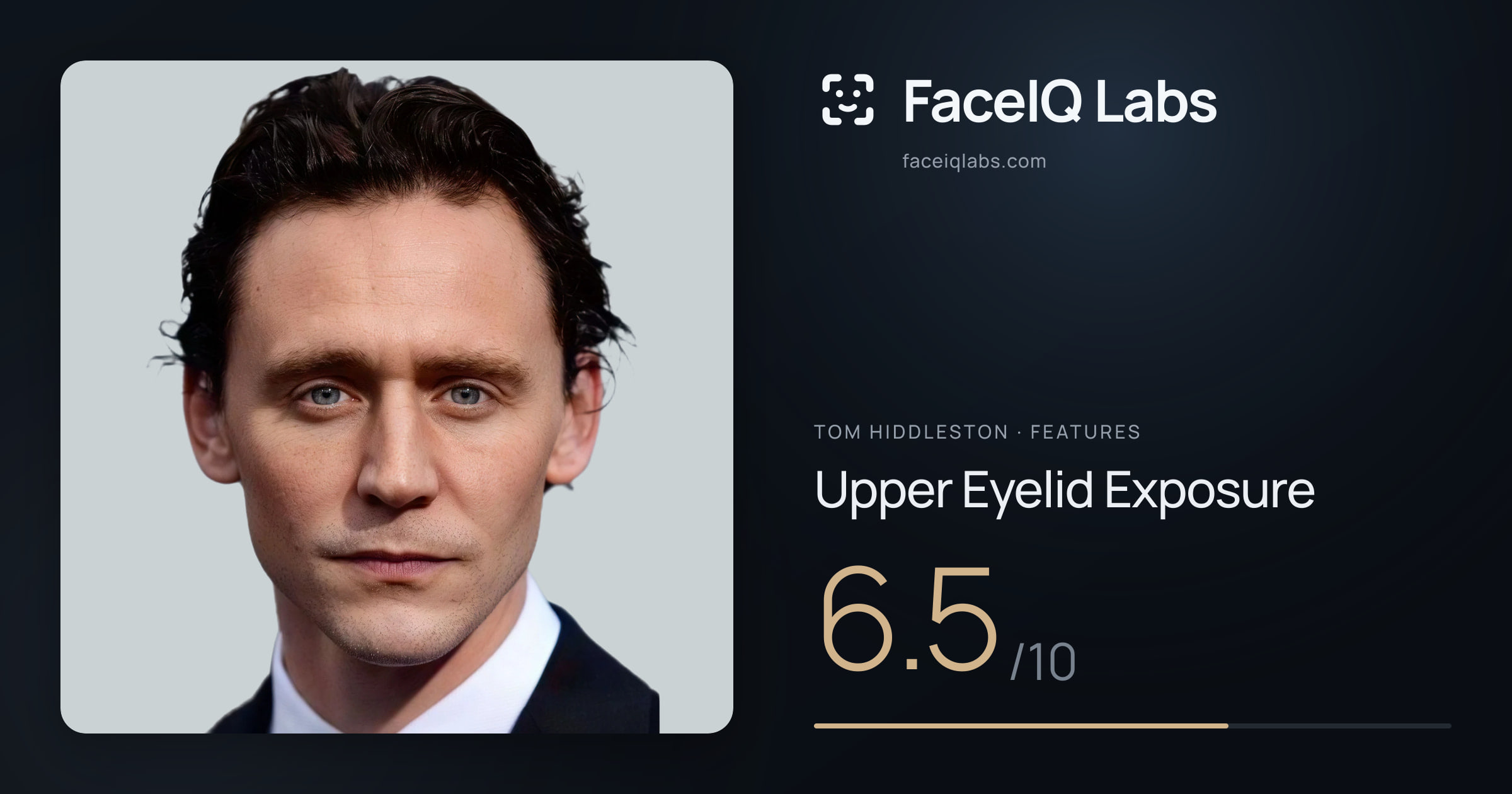 Tom Hiddleston Upper Eyelid Exposure: 6.5/10, drawn on the photo