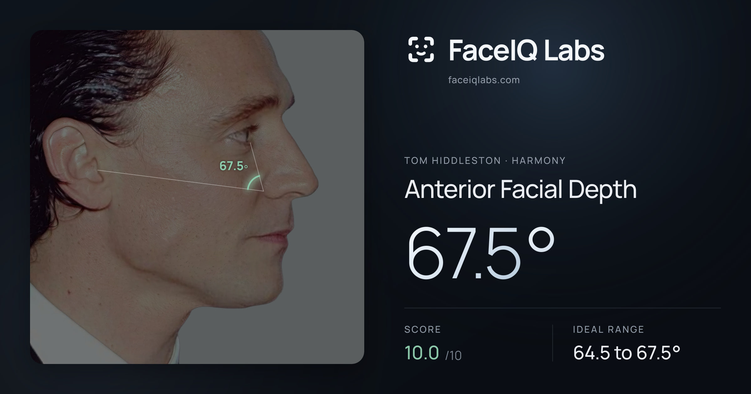 Tom Hiddleston Anterior Facial Depth: 67.5°, drawn on the photo