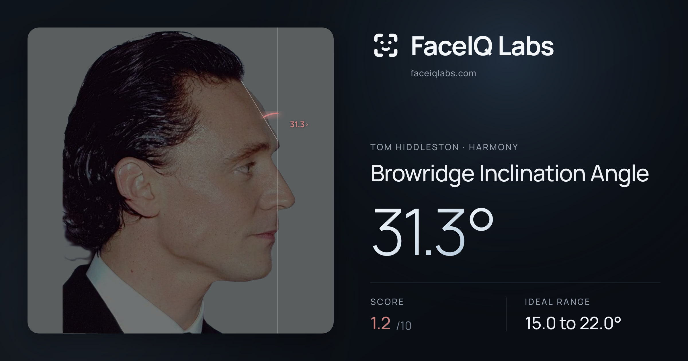 Tom Hiddleston Browridge Inclination Angle: 31.3°, drawn on the photo