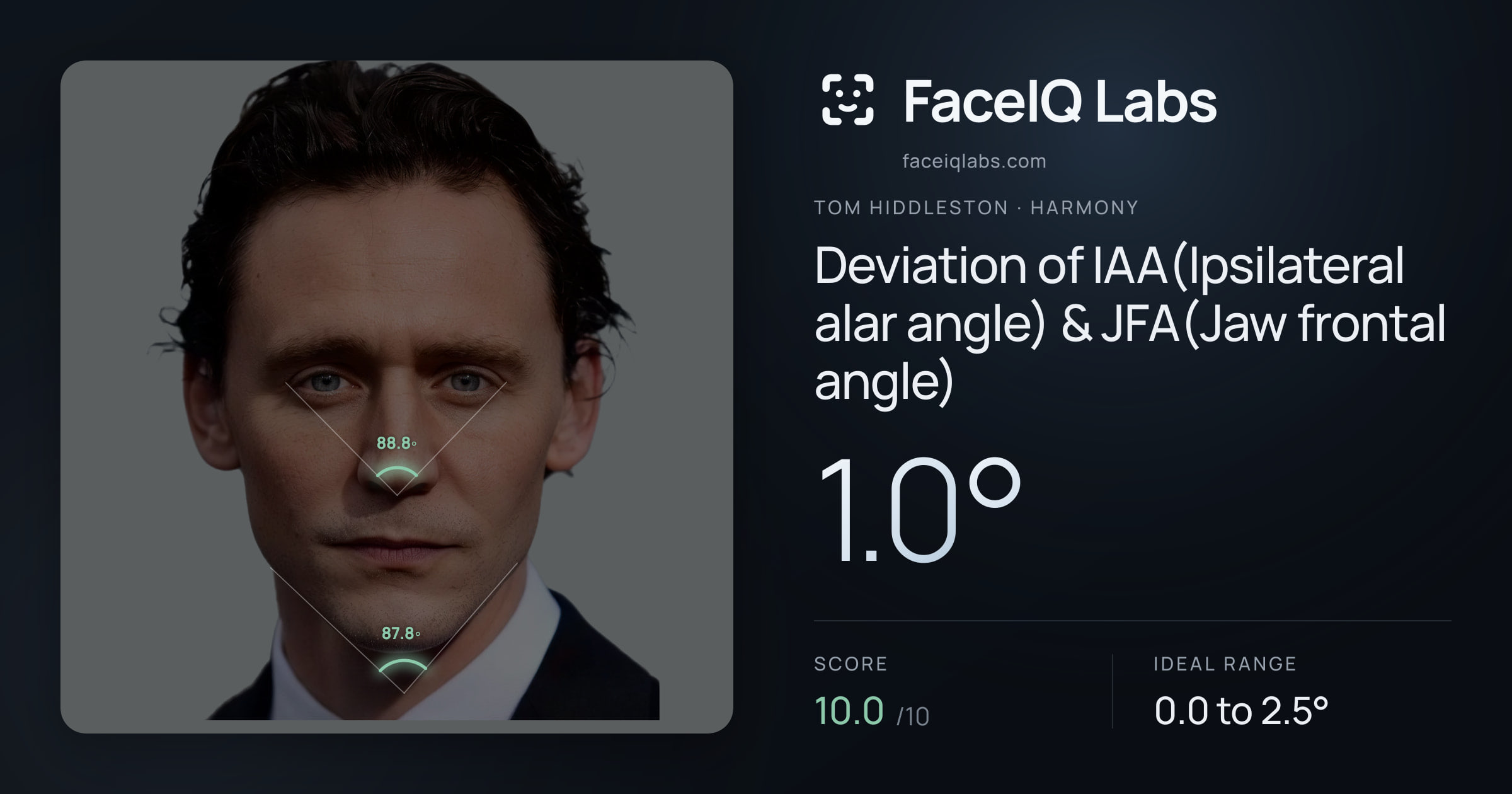 Tom Hiddleston Deviation of IAA(Ipsilateral alar angle) & JFA(Jaw frontal angle): 1.0°, drawn on the photo