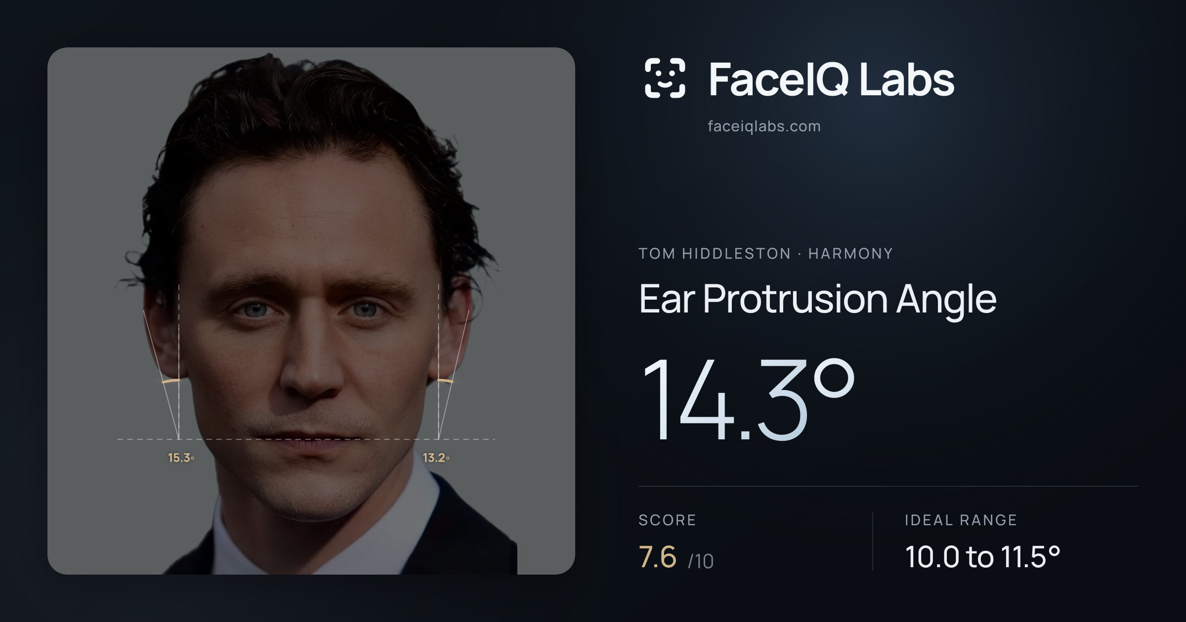 Tom Hiddleston Ear Protrusion Angle: 14.3°, drawn on the photo