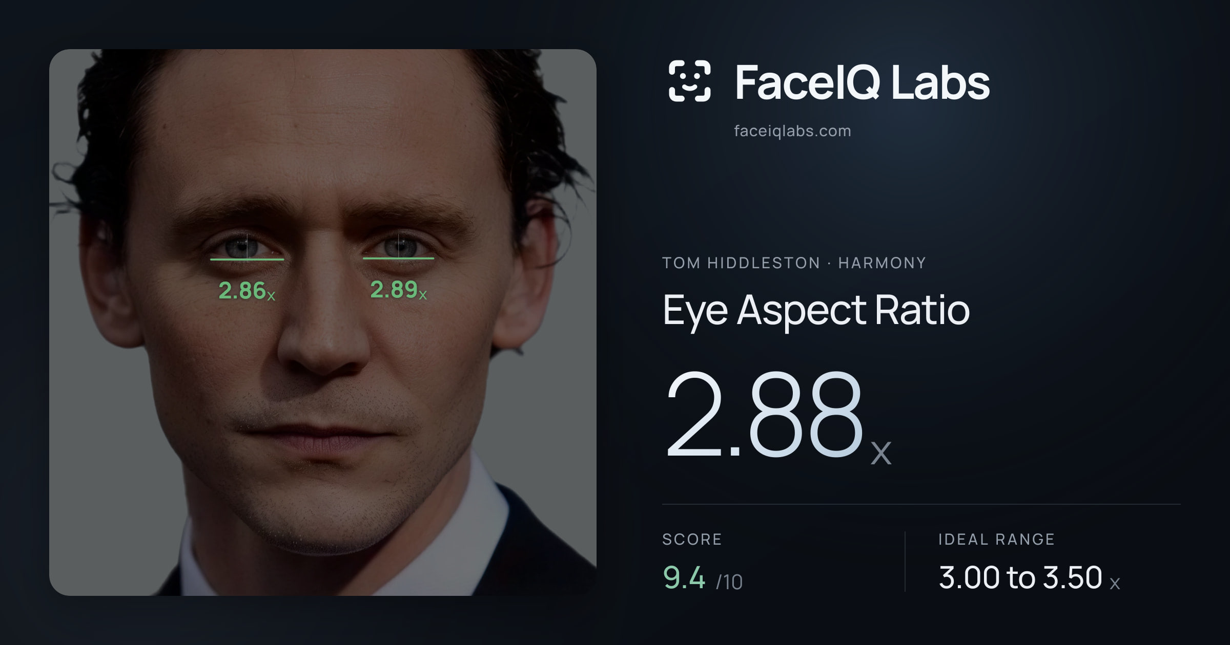 Tom Hiddleston Eye Aspect Ratio: 2.88x, drawn on the photo
