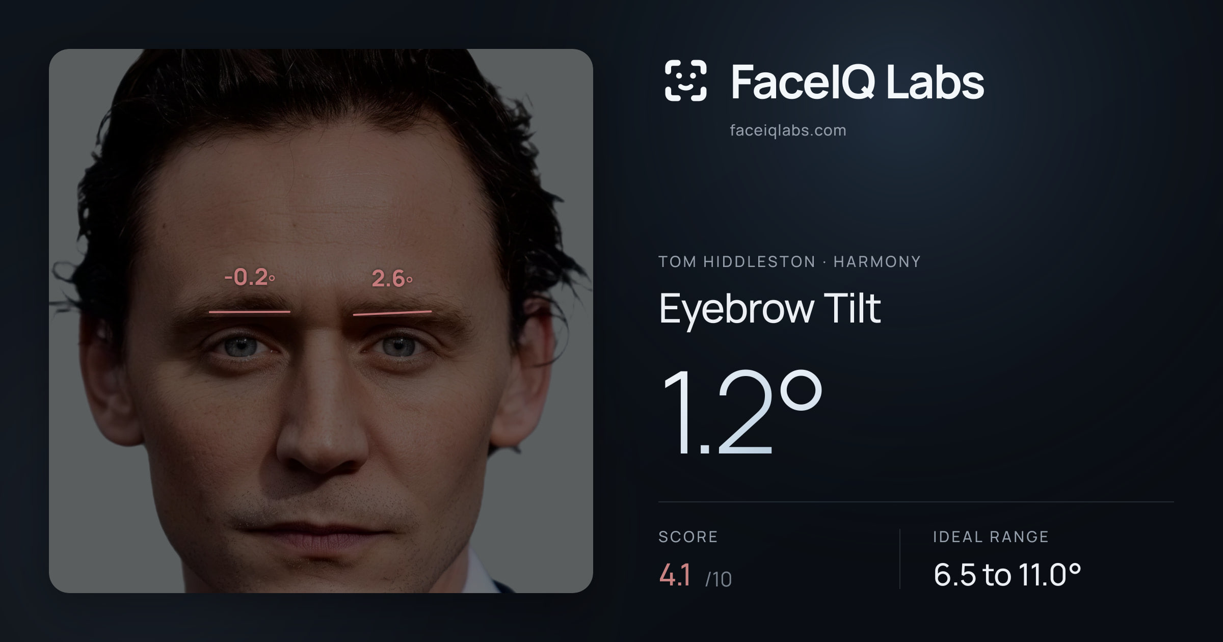Tom Hiddleston Eyebrow Tilt: 1.2°, drawn on the photo