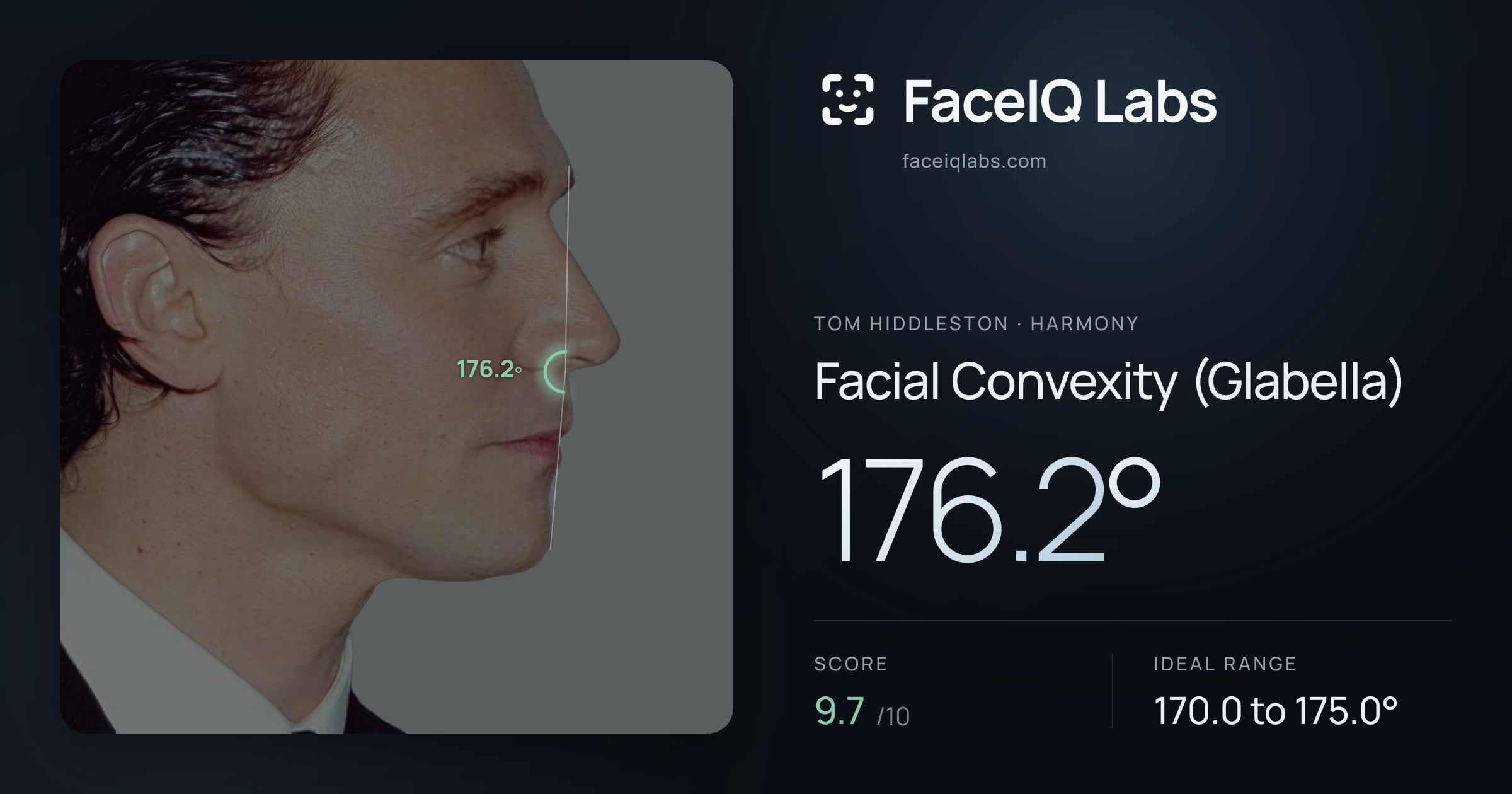 Tom Hiddleston Facial Convexity (Glabella): 176.2°, drawn on the photo