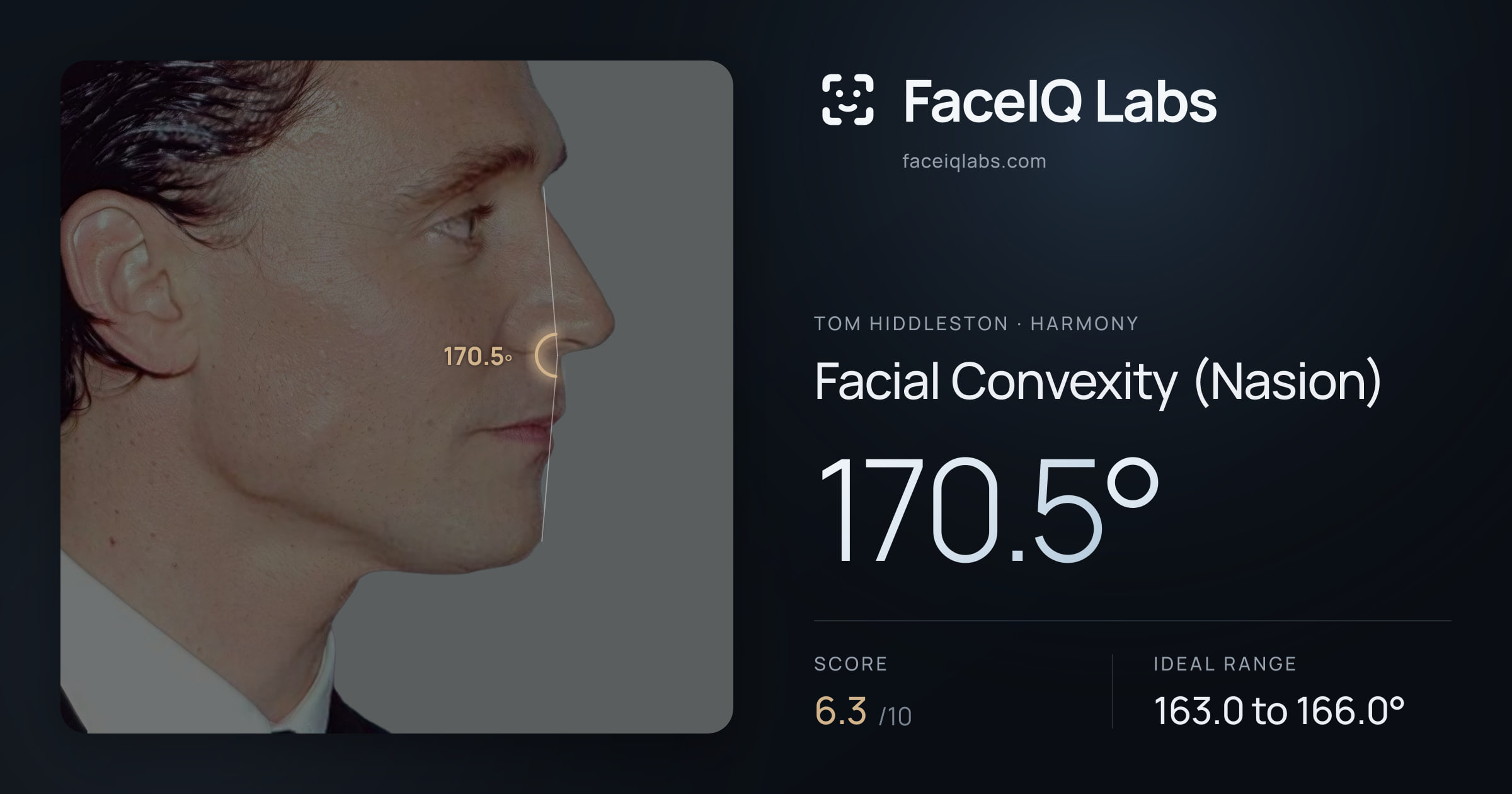 Tom Hiddleston Facial Convexity (Nasion): 170.5°, drawn on the photo