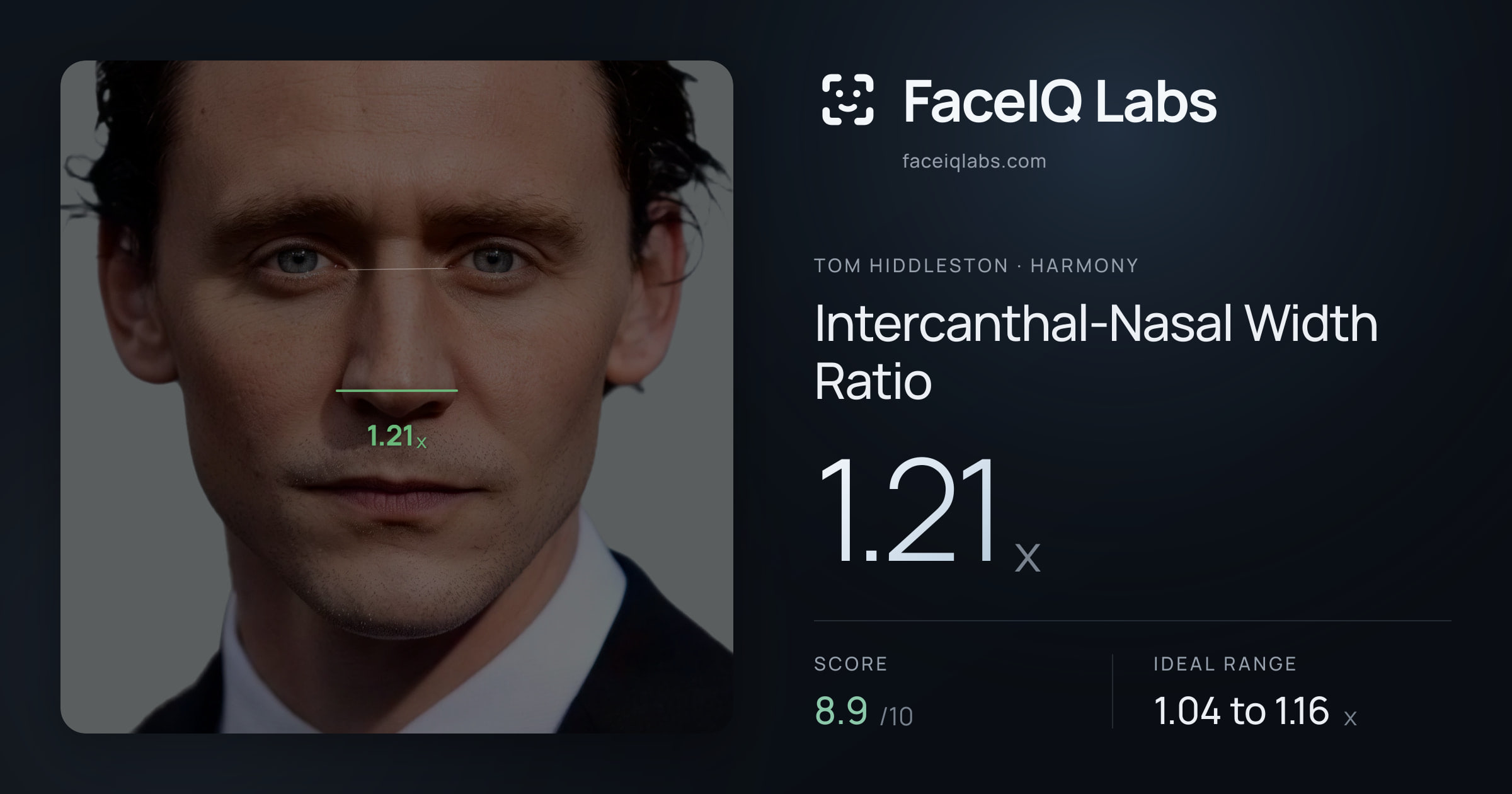 Tom Hiddleston Intercanthal-Nasal Width Ratio: 1.21x, drawn on the photo