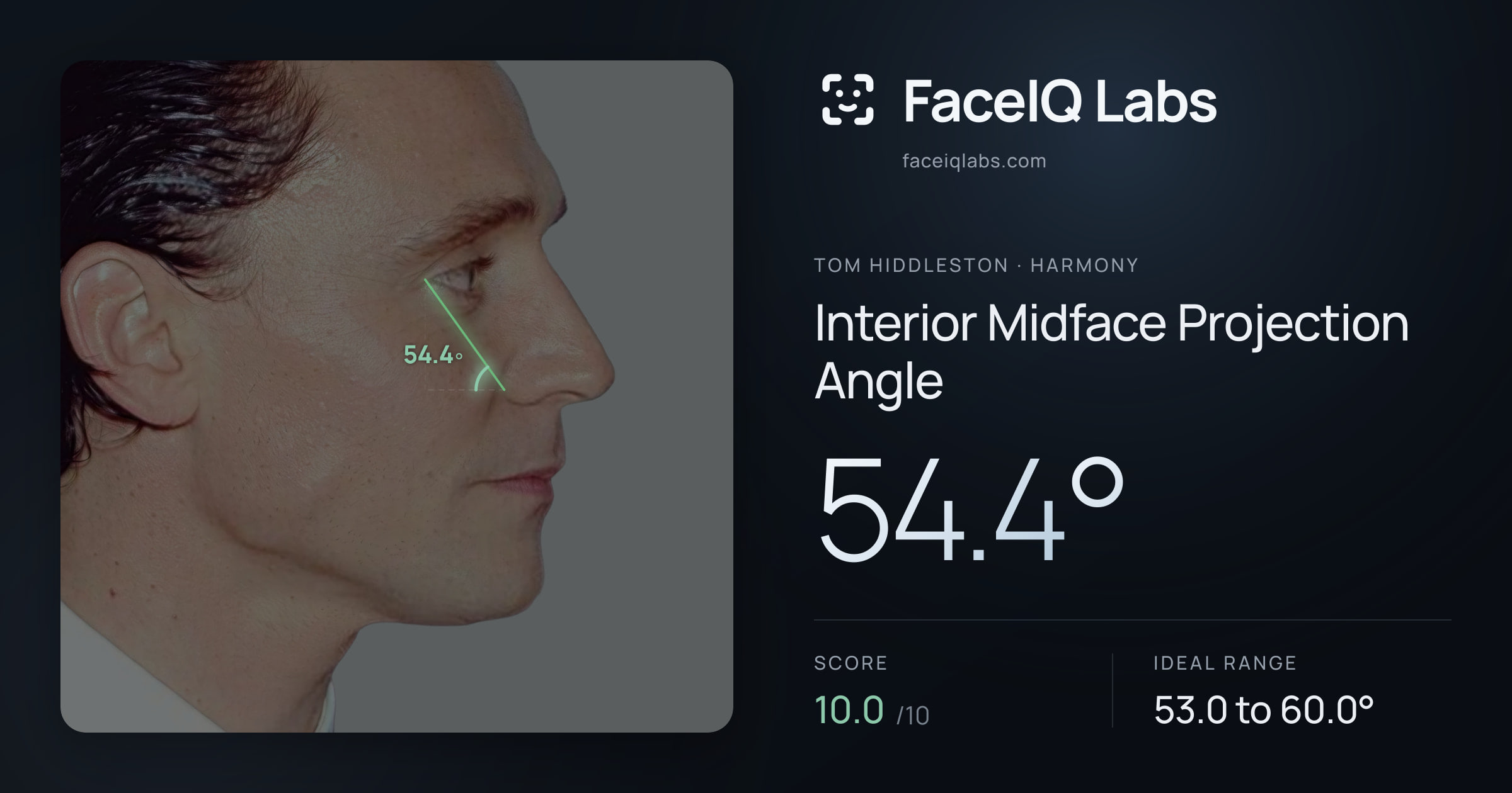 Tom Hiddleston Interior Midface Projection Angle: 54.4°, drawn on the photo