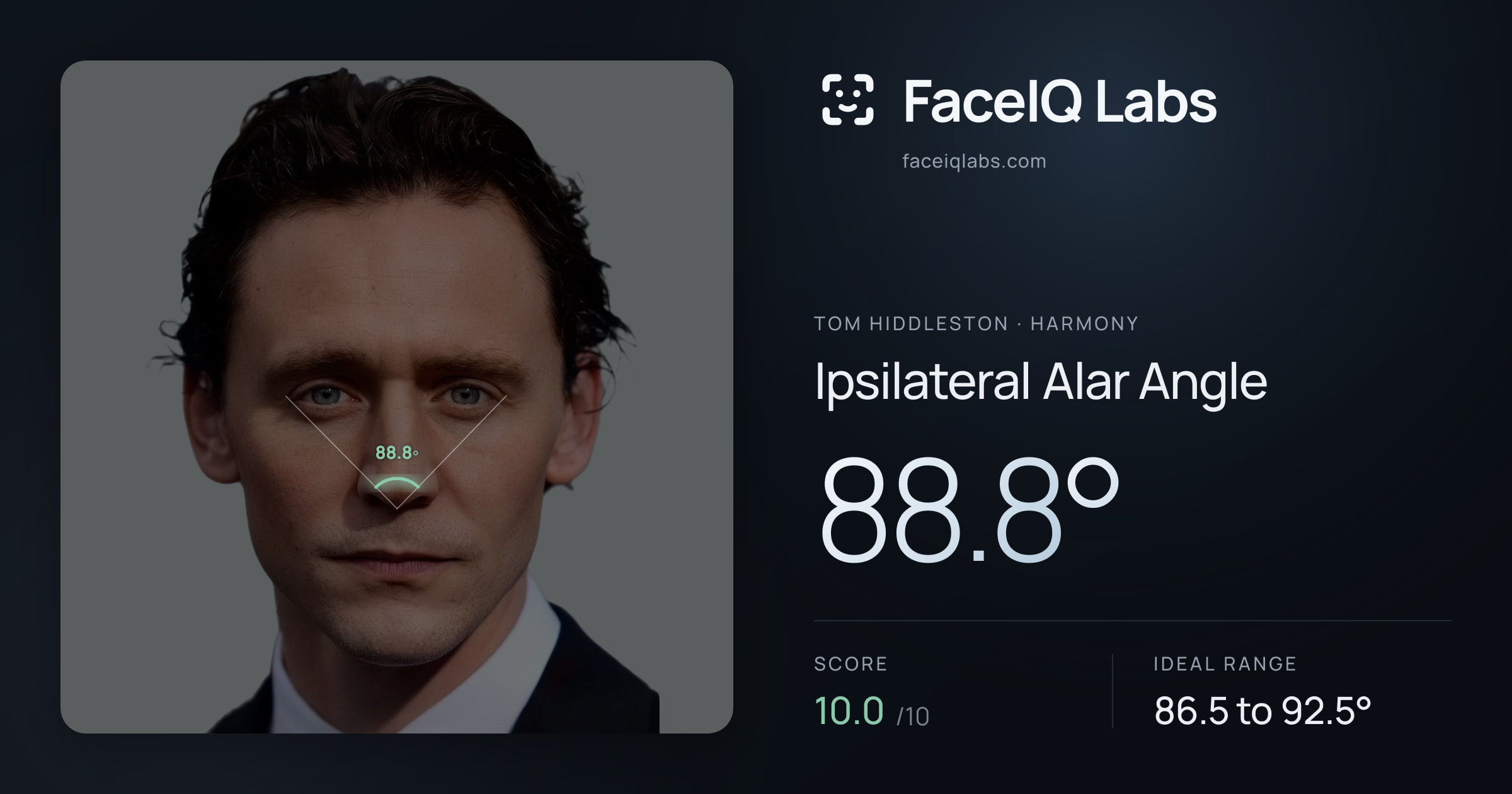 Tom Hiddleston Ipsilateral Alar Angle: 88.8°, drawn on the photo