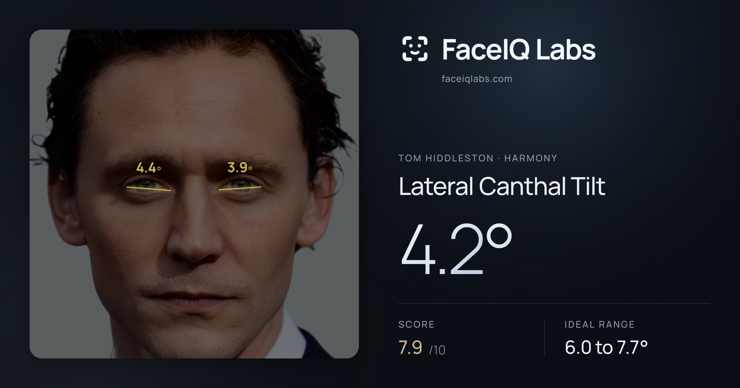 Tom Hiddleston Lateral Canthal Tilt: 4.2°, drawn on the photo