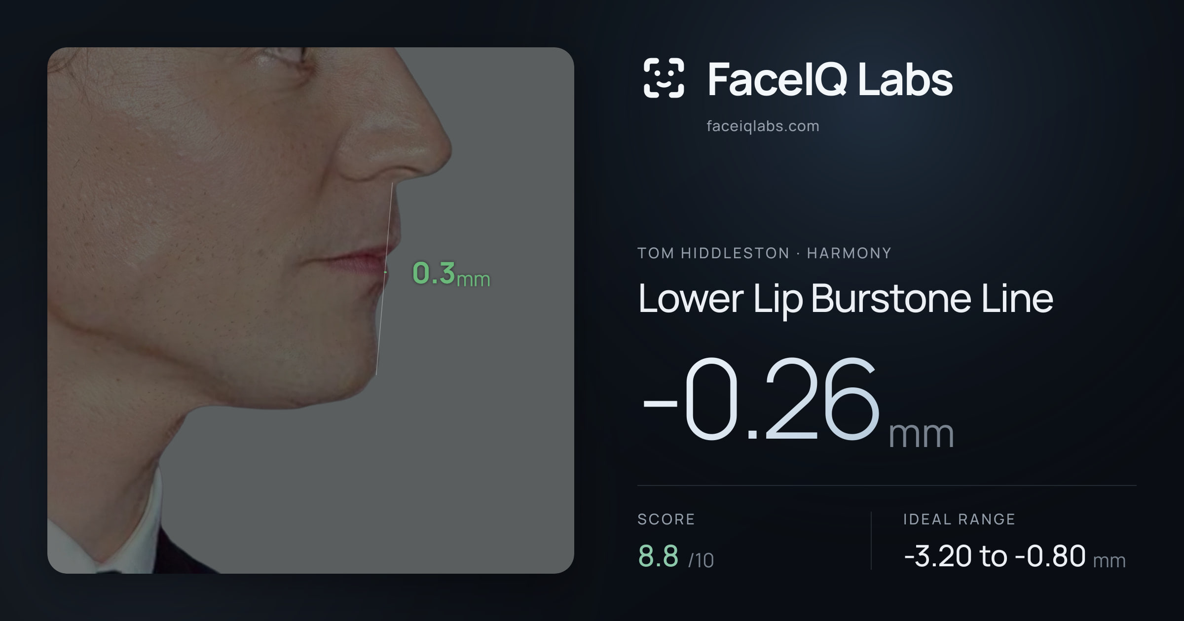 Tom Hiddleston Lower Lip Burstone Line: -0.26mm, drawn on the photo