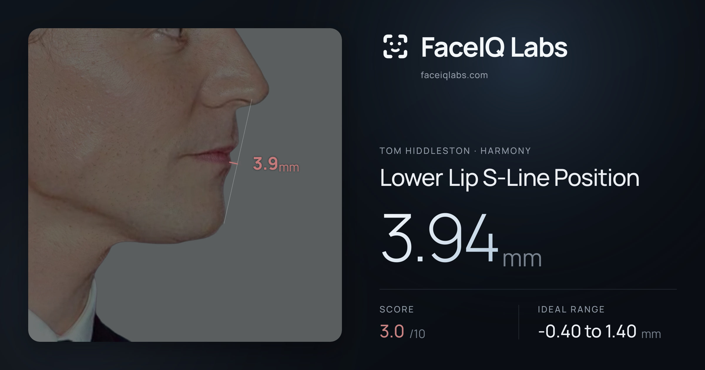 Tom Hiddleston Lower Lip S-Line Position: 3.94mm, drawn on the photo