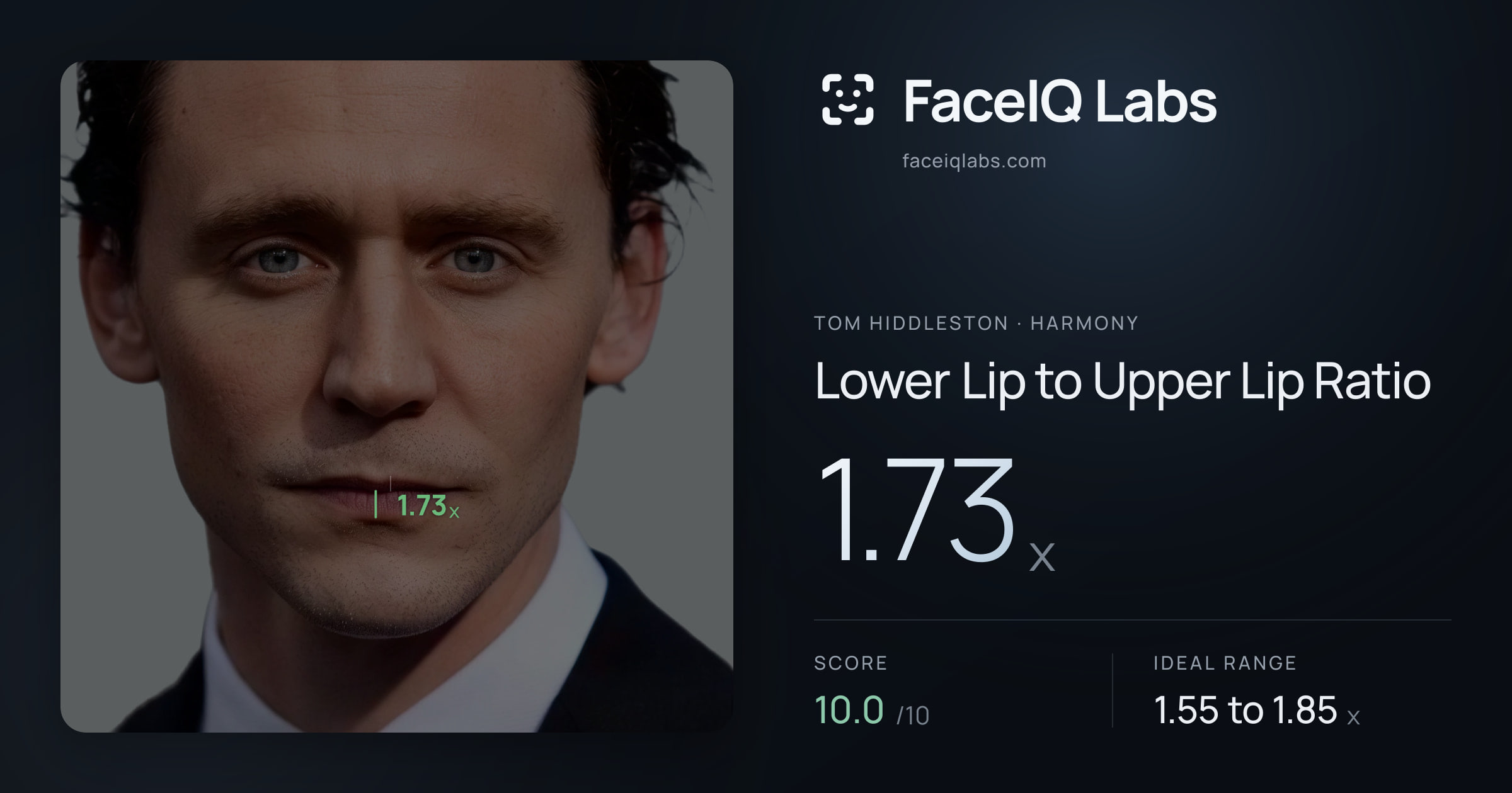 Tom Hiddleston Lower Lip to Upper Lip Ratio: 1.73x, drawn on the photo