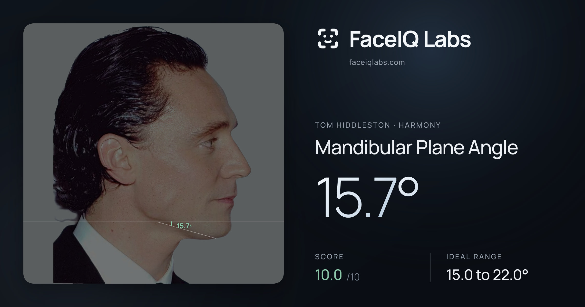 Tom Hiddleston Mandibular Plane Angle: 15.7°, drawn on the photo