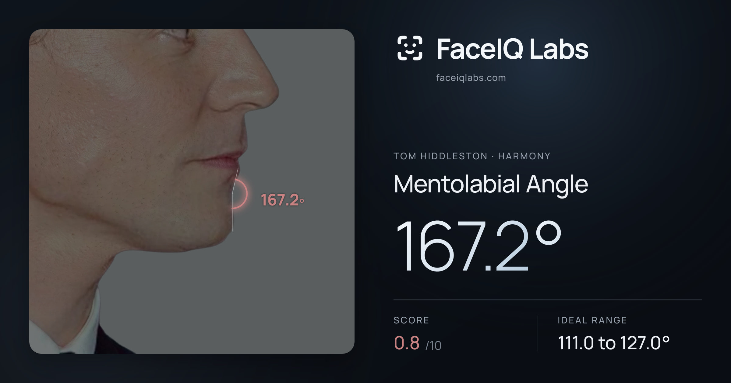 Tom Hiddleston Mentolabial Angle: 167.2°, drawn on the photo