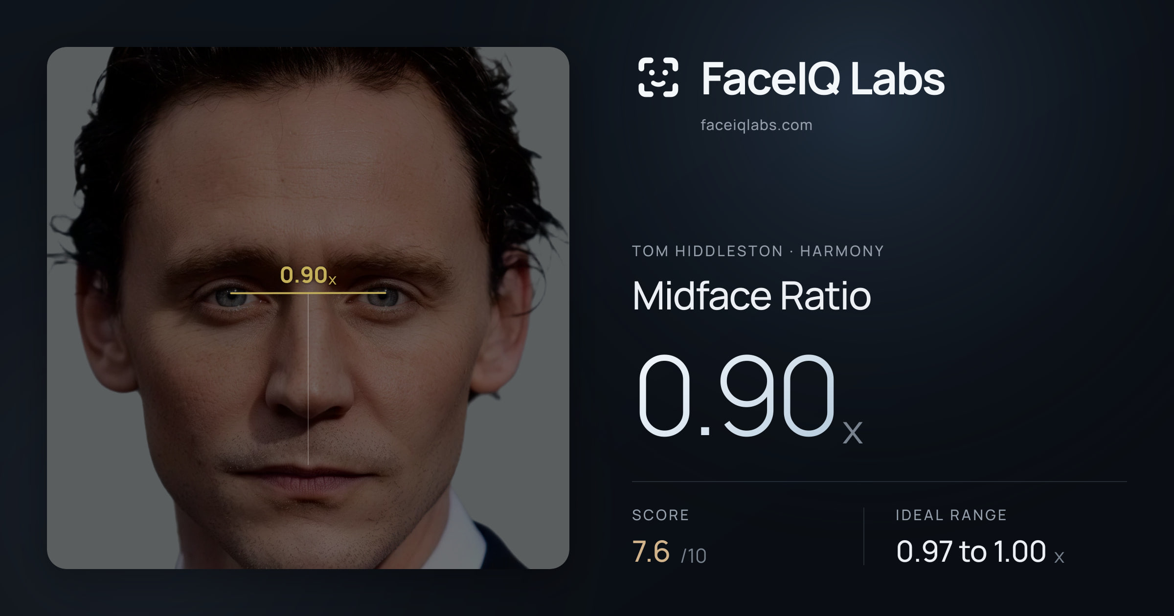 Tom Hiddleston Midface Ratio: 0.90x, drawn on the photo