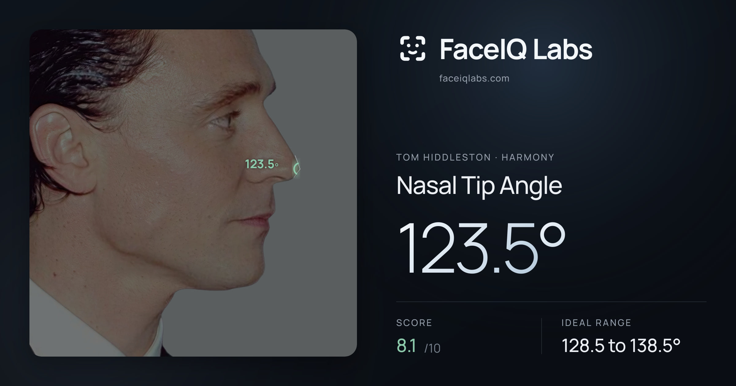 Tom Hiddleston Nasal Tip Angle: 123.5°, drawn on the photo