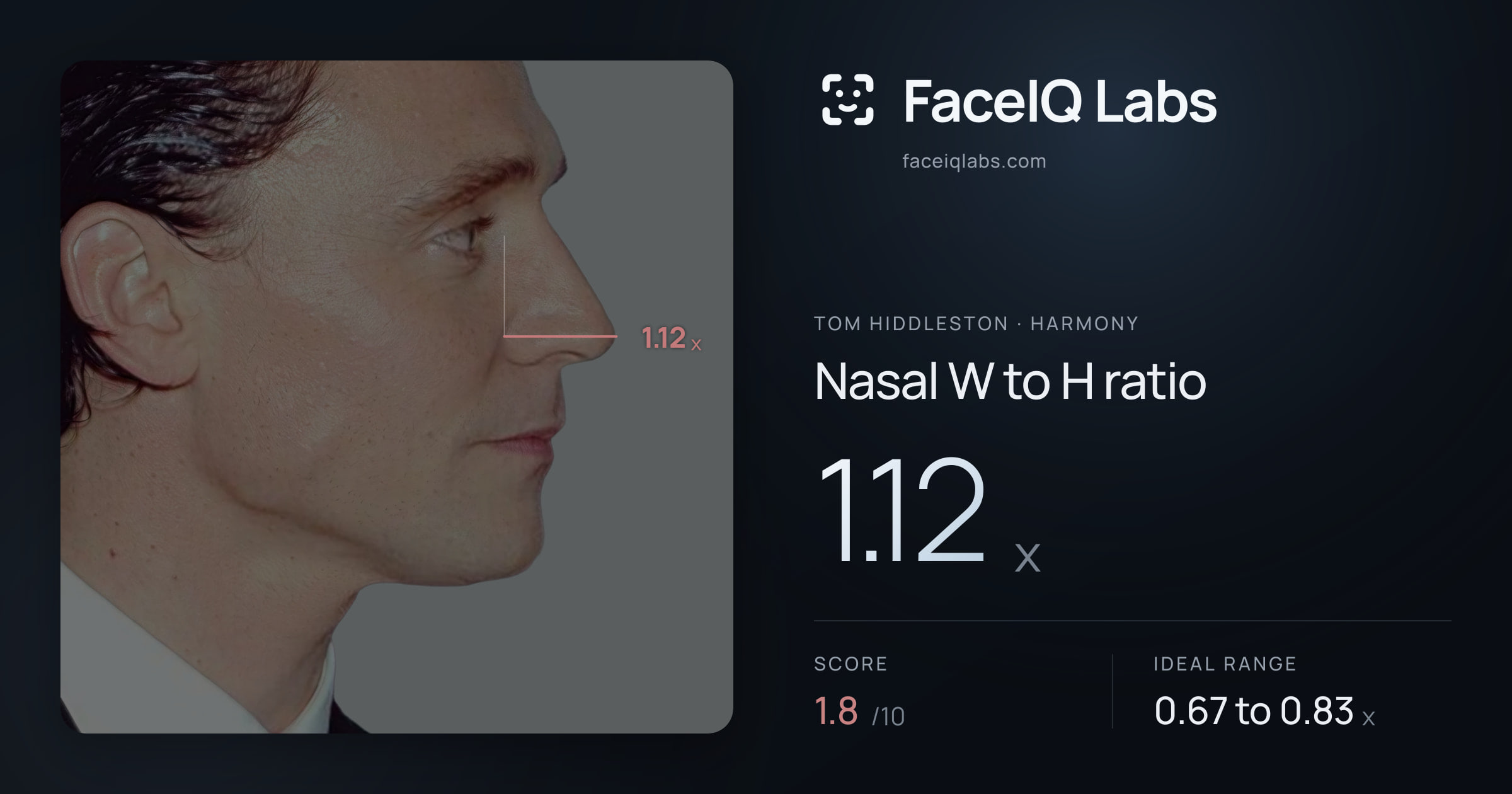 Tom Hiddleston Nasal W to H ratio: 1.12x, drawn on the photo