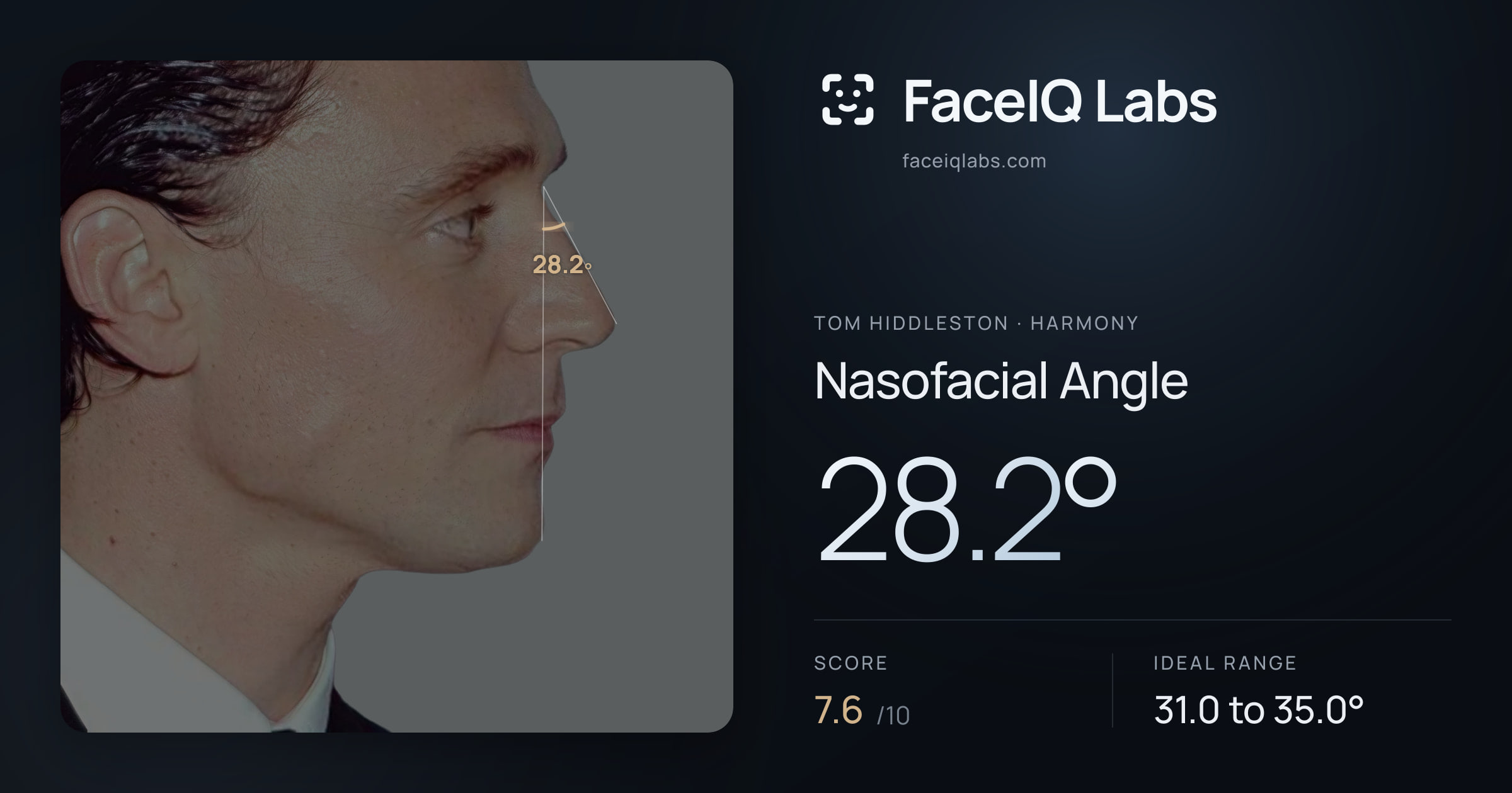 Tom Hiddleston Nasofacial Angle: 28.2°, drawn on the photo