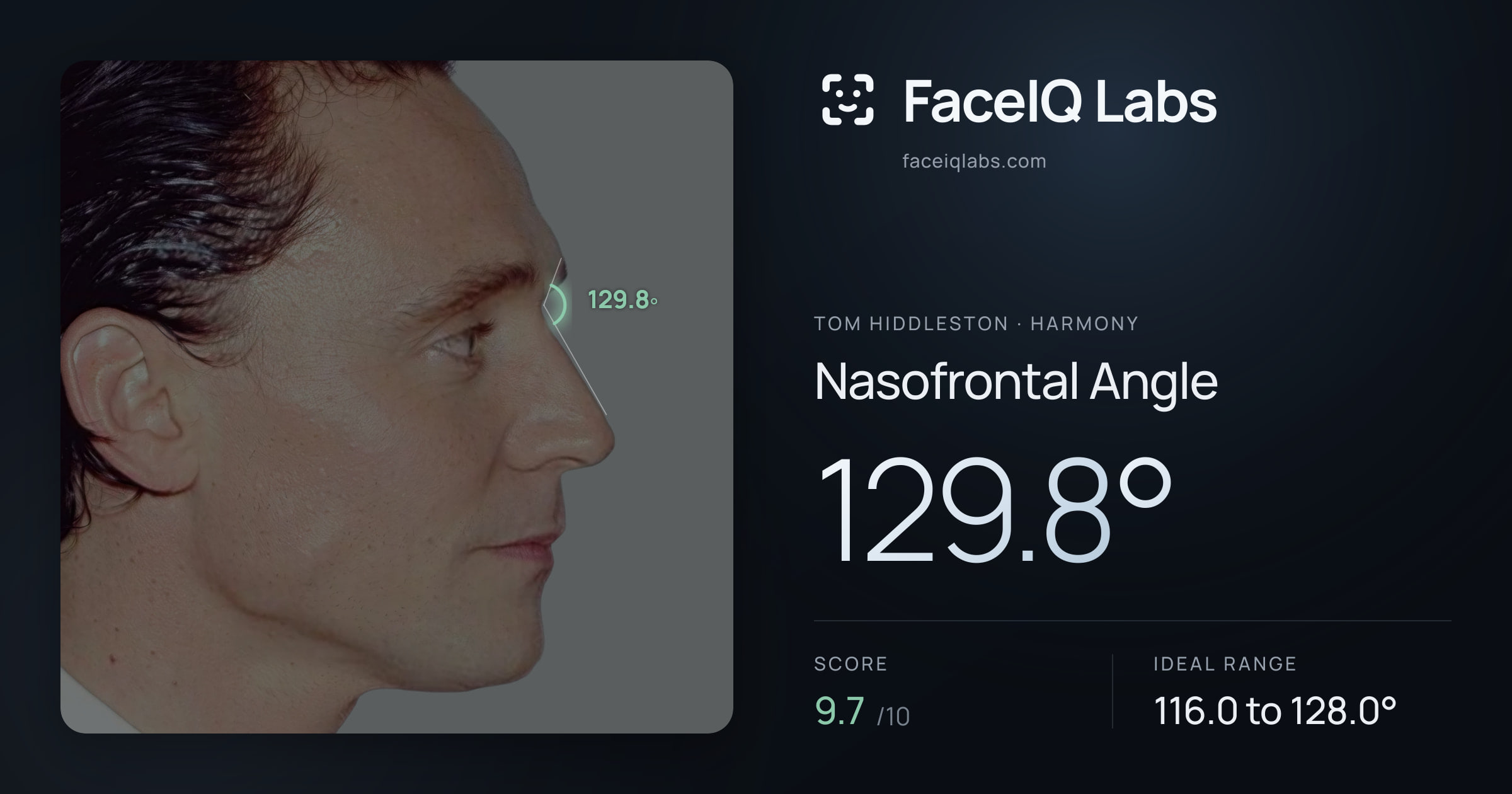 Tom Hiddleston Nasofrontal Angle: 129.8°, drawn on the photo