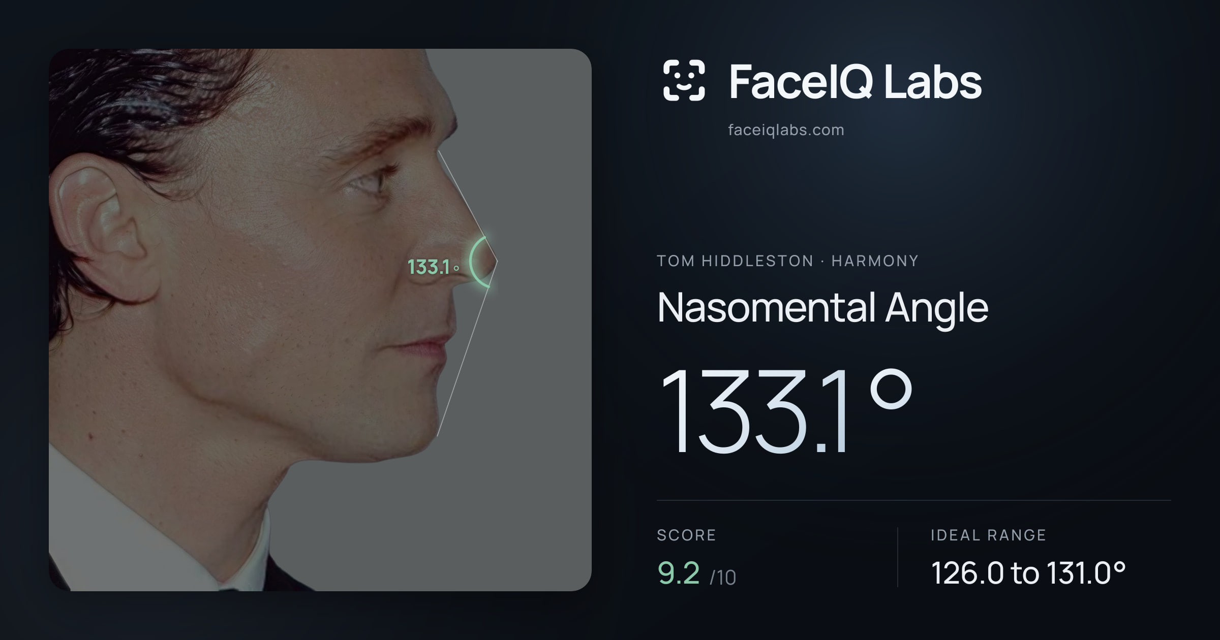 Tom Hiddleston Nasomental Angle: 133.1°, drawn on the photo
