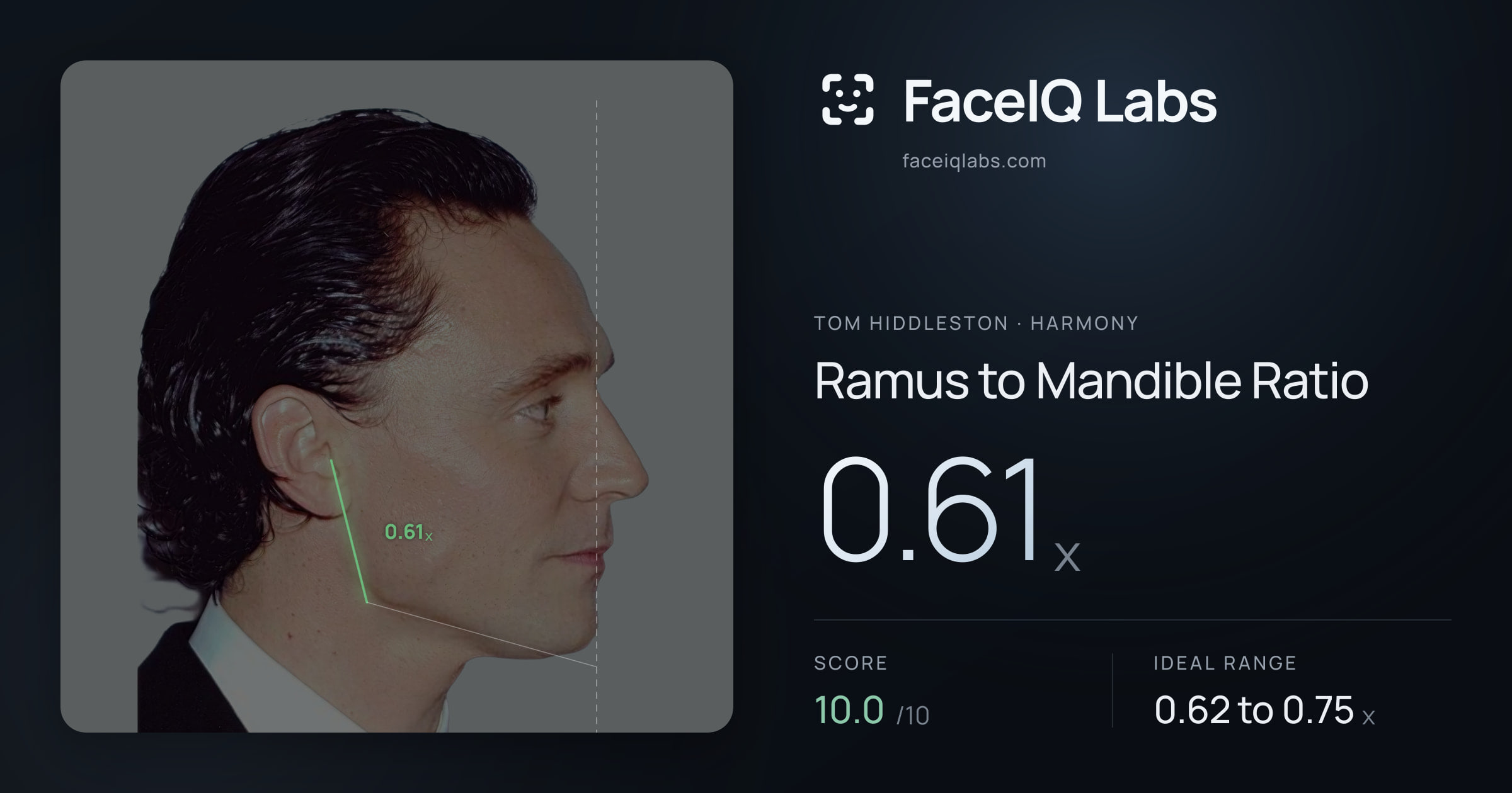Tom Hiddleston Ramus to Mandible Ratio: 0.61x, drawn on the photo