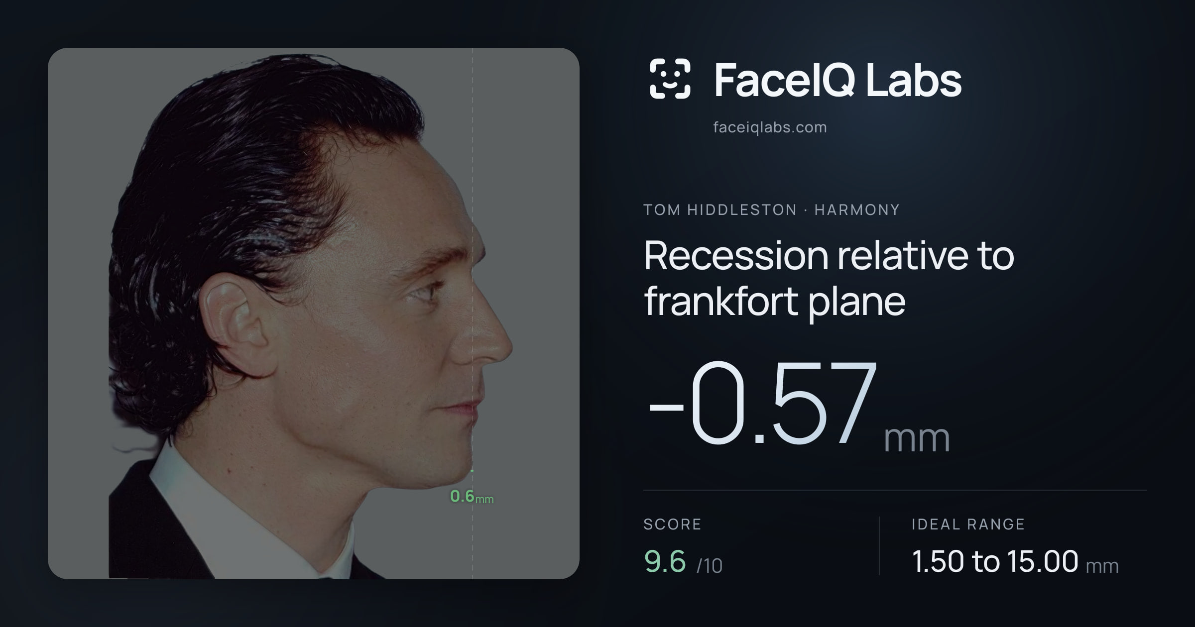 Tom Hiddleston Recession relative to frankfort plane: -0.57mm, drawn on the photo