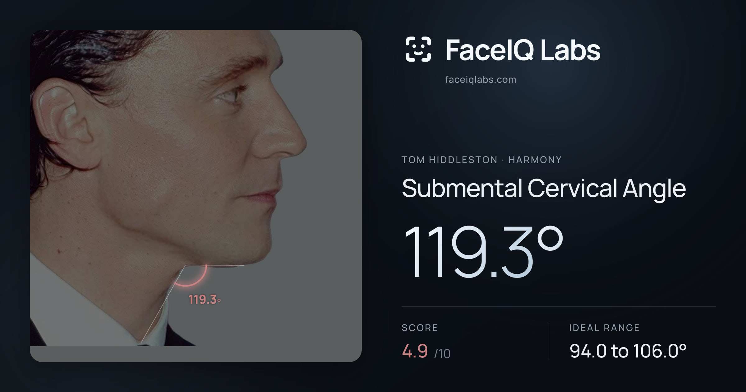 Tom Hiddleston Submental Cervical Angle: 119.3°, drawn on the photo