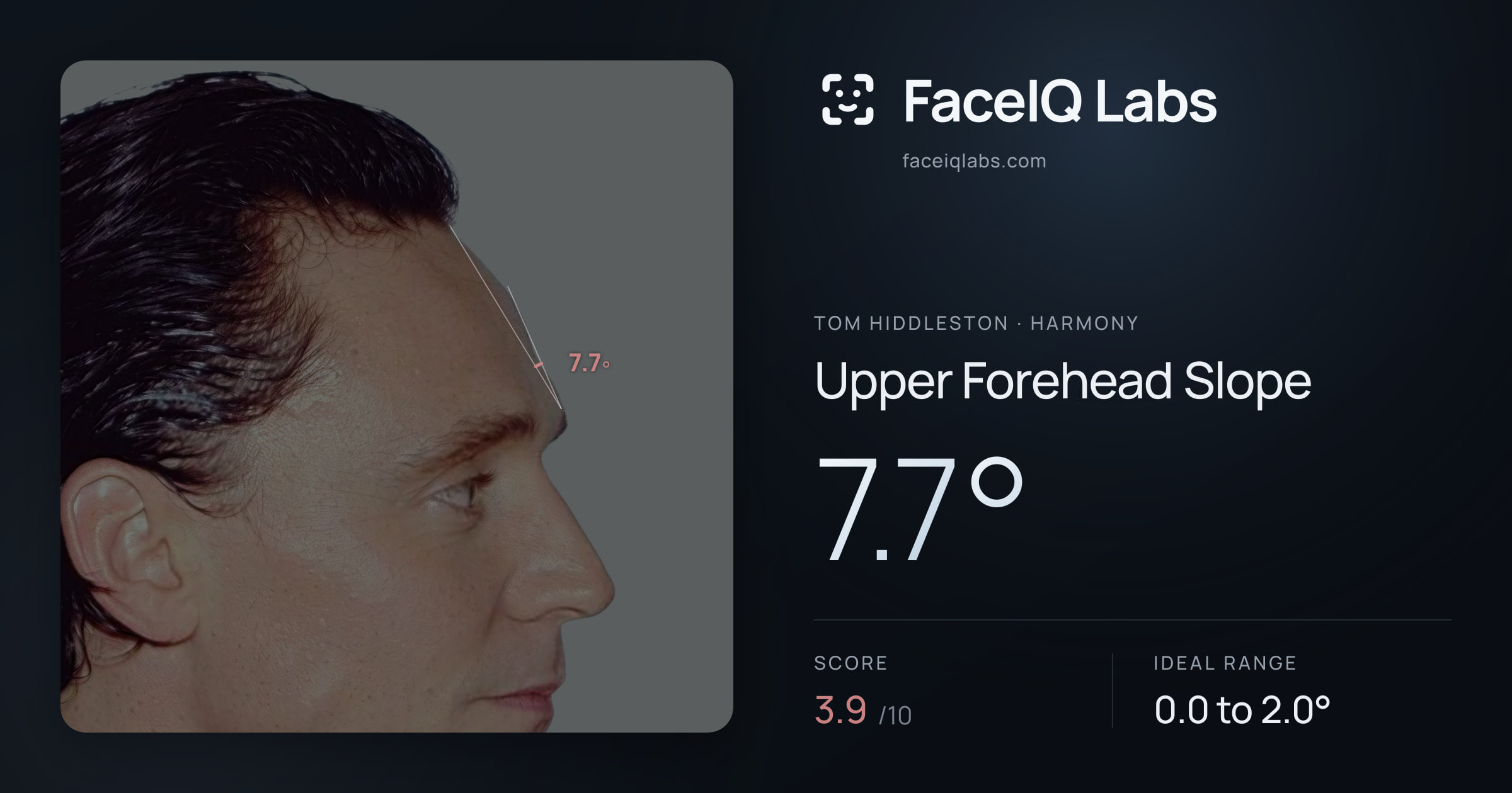 Tom Hiddleston Upper Forehead Slope: 7.7°, drawn on the photo