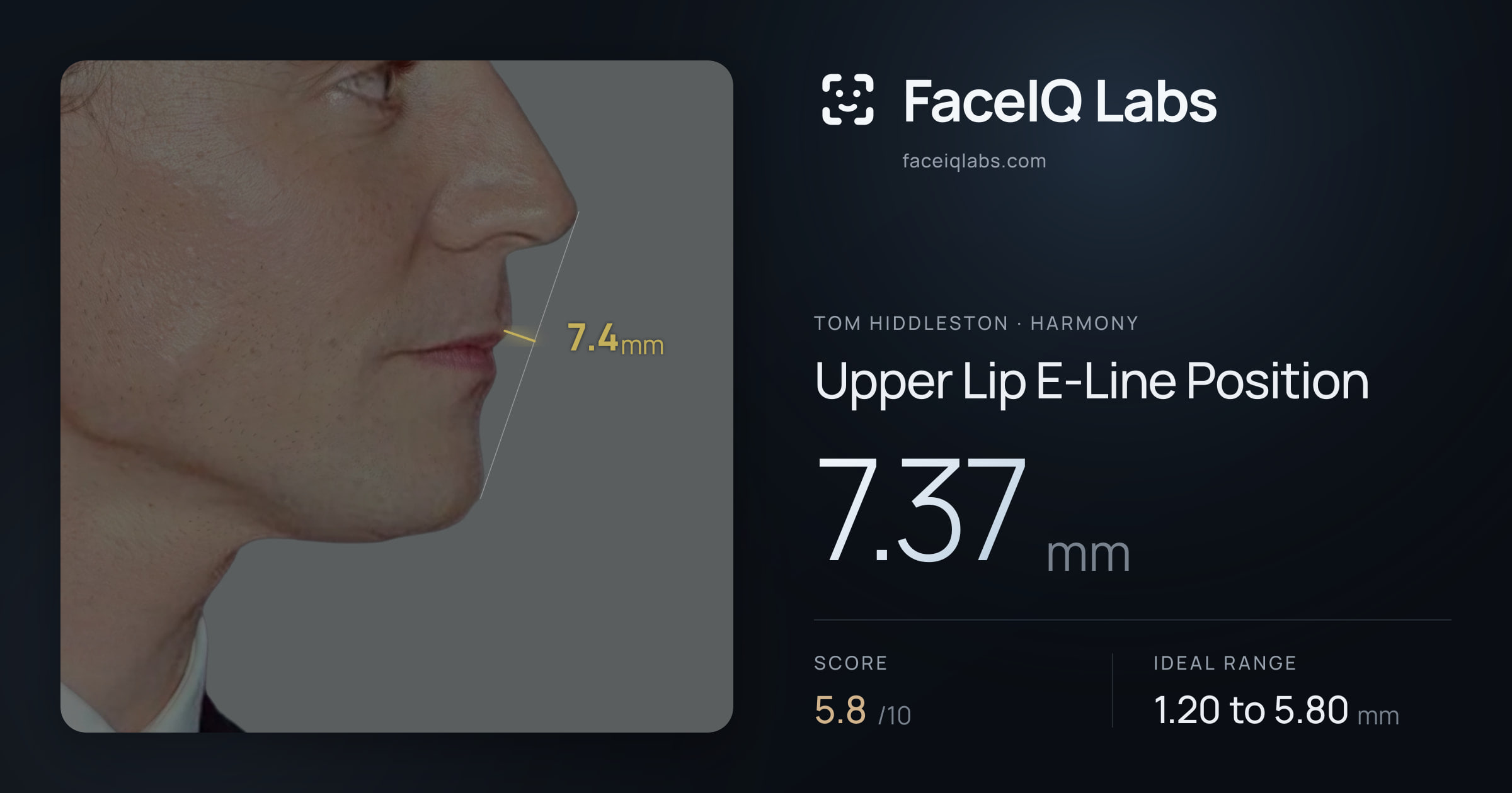 Tom Hiddleston Upper Lip E-Line Position: 7.37mm, drawn on the photo