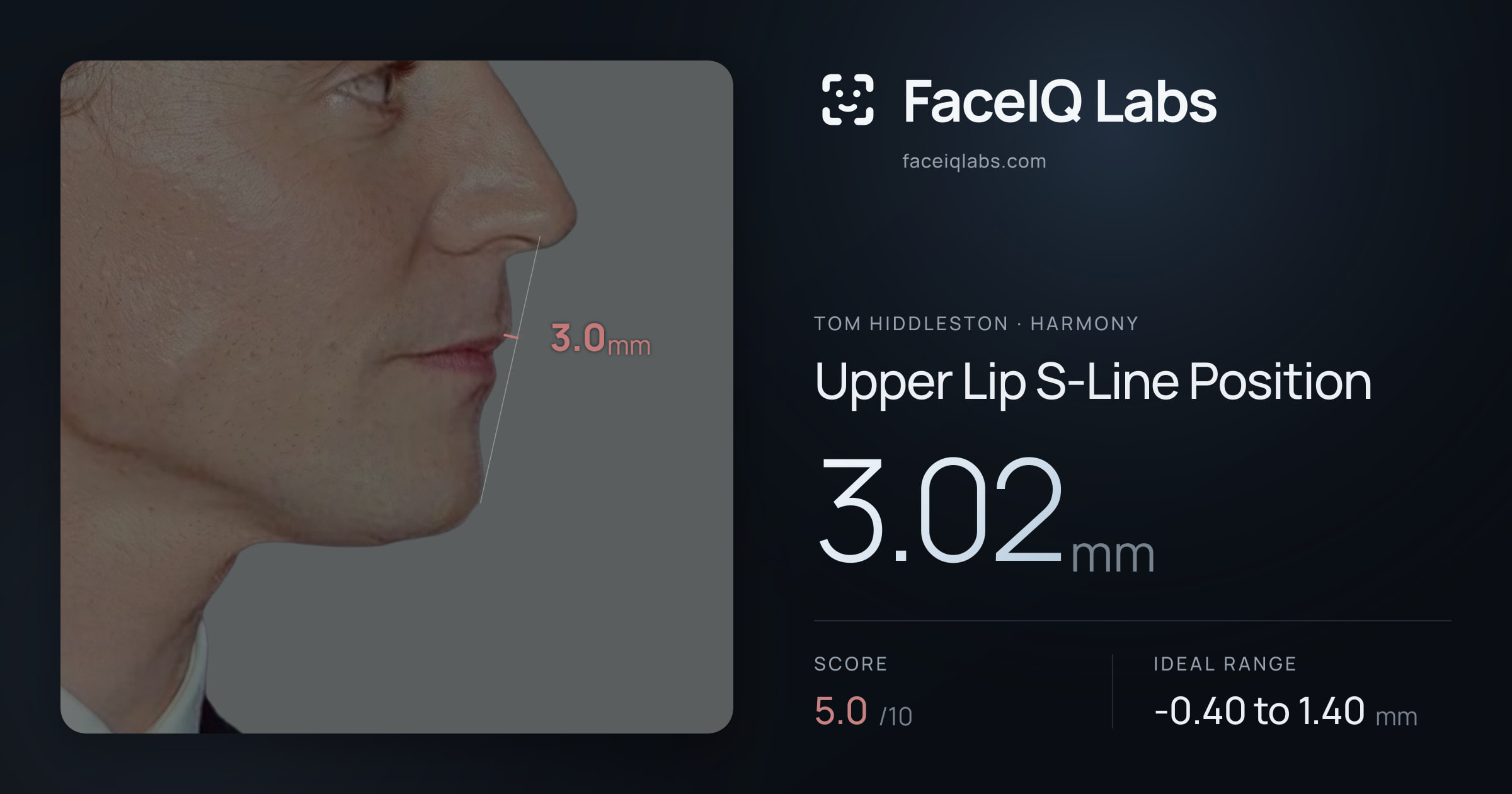 Tom Hiddleston Upper Lip S-Line Position: 3.02mm, drawn on the photo