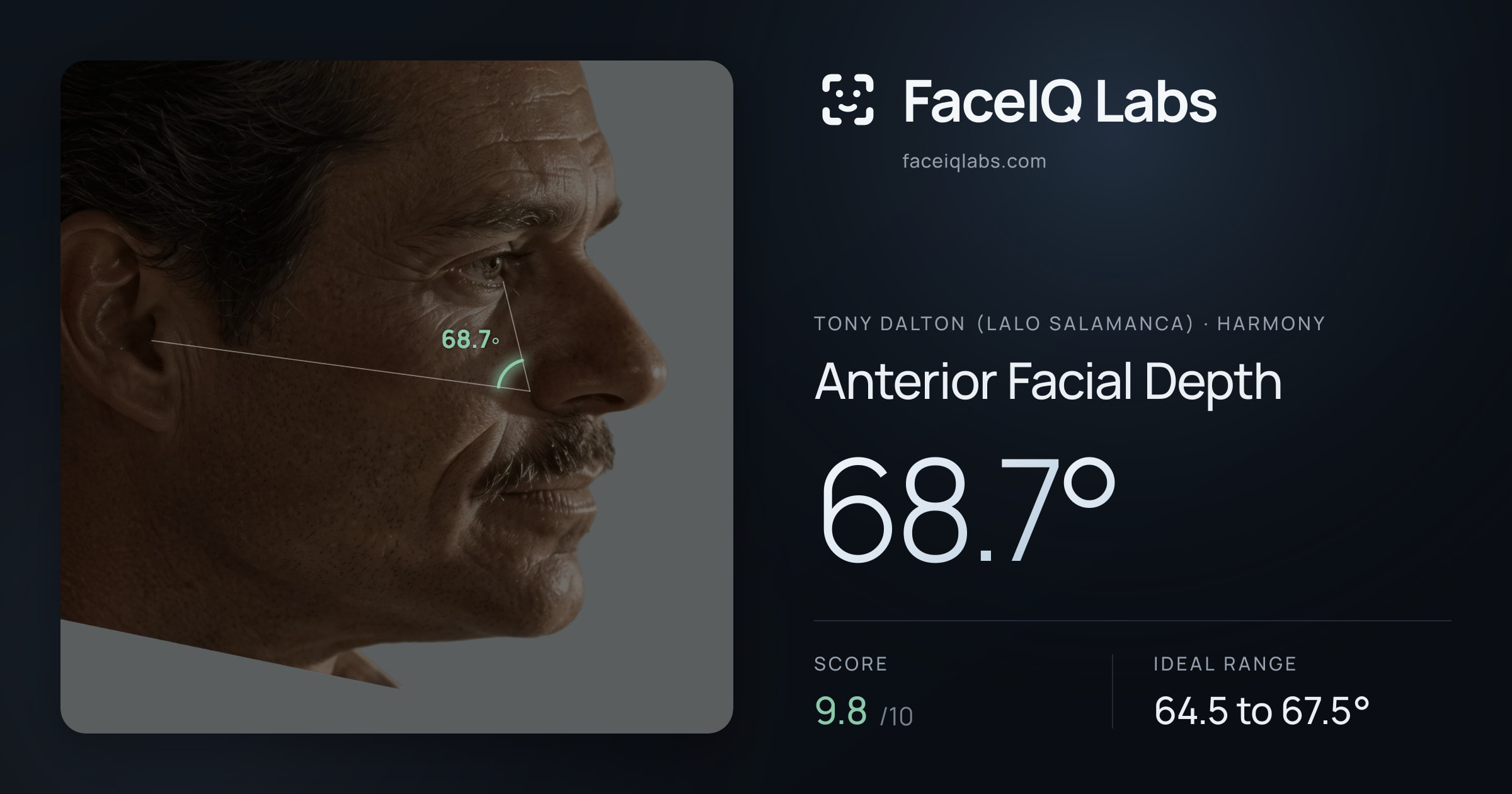 Tony Dalton (Lalo Salamanca) Anterior Facial Depth: 68.7°, drawn on the photo