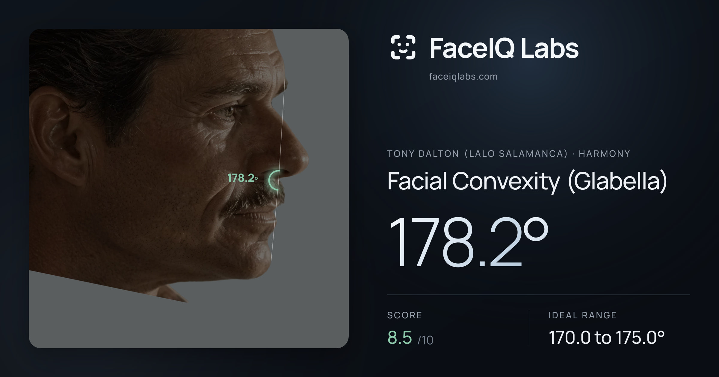 Tony Dalton (Lalo Salamanca) Facial Convexity (Glabella): 178.2°, drawn on the photo