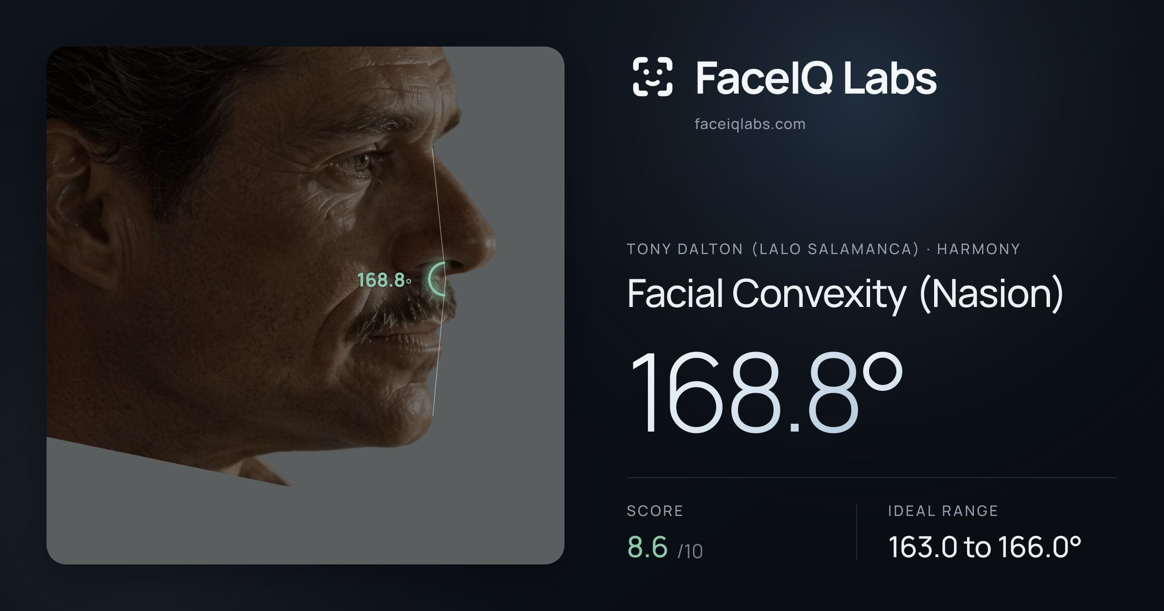 Tony Dalton (Lalo Salamanca) Facial Convexity (Nasion): 168.8°, drawn on the photo