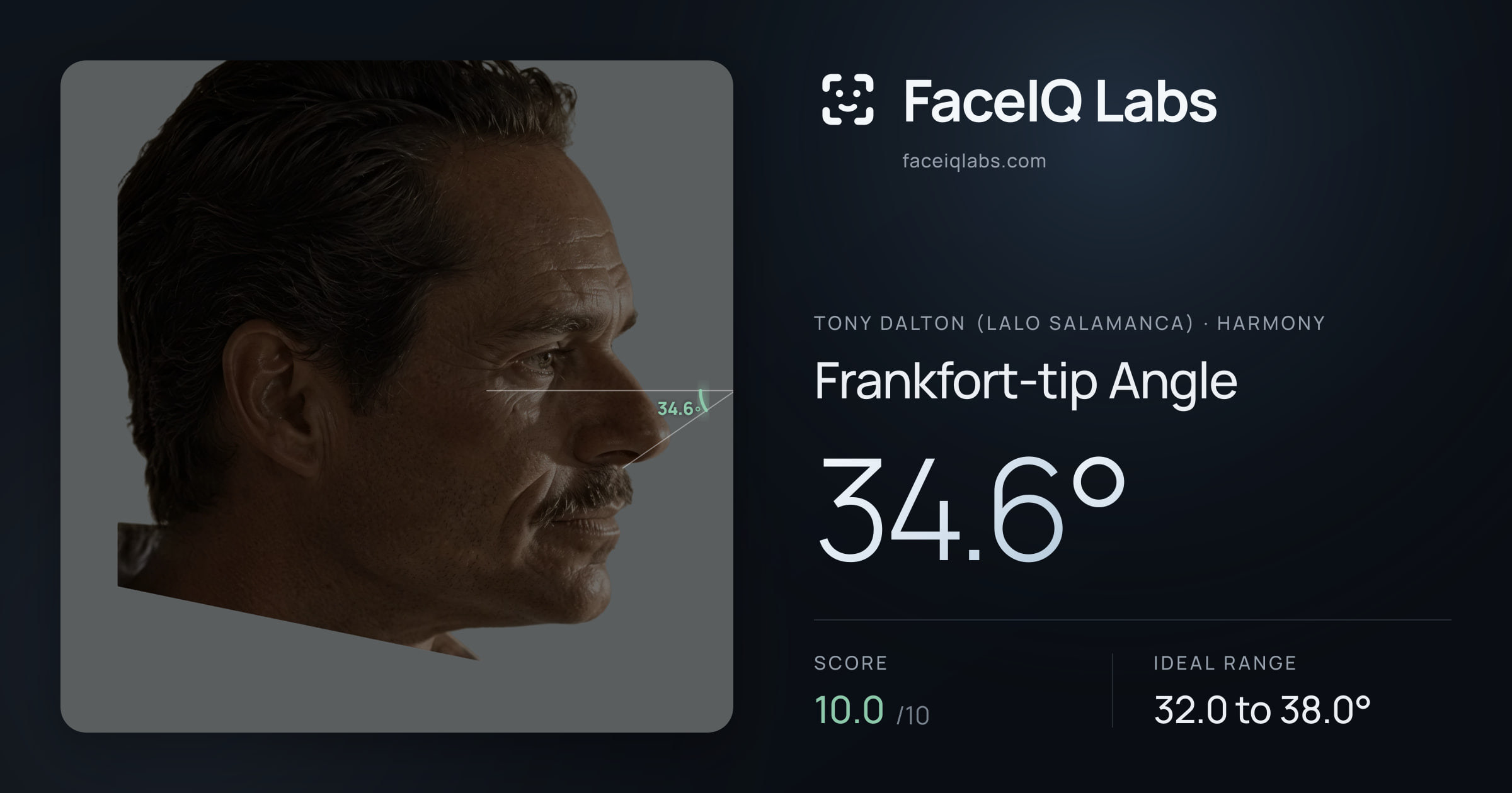 Tony Dalton (Lalo Salamanca) Frankfort-tip Angle: 34.6°, drawn on the photo