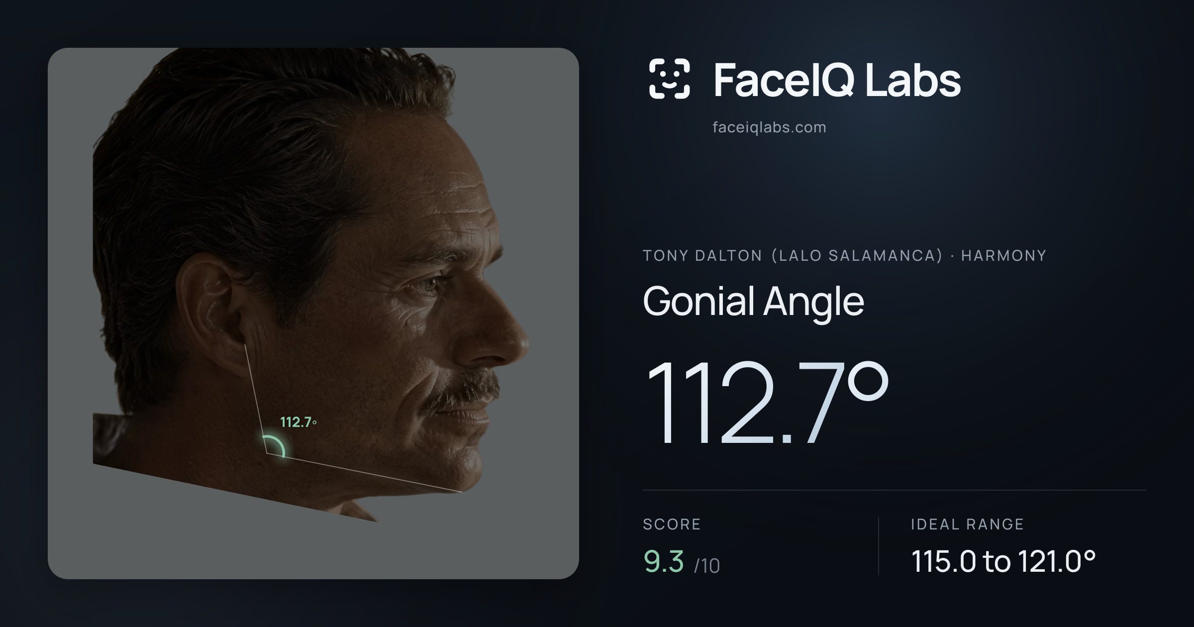 Tony Dalton (Lalo Salamanca) Gonial Angle: 112.7°, drawn on the photo