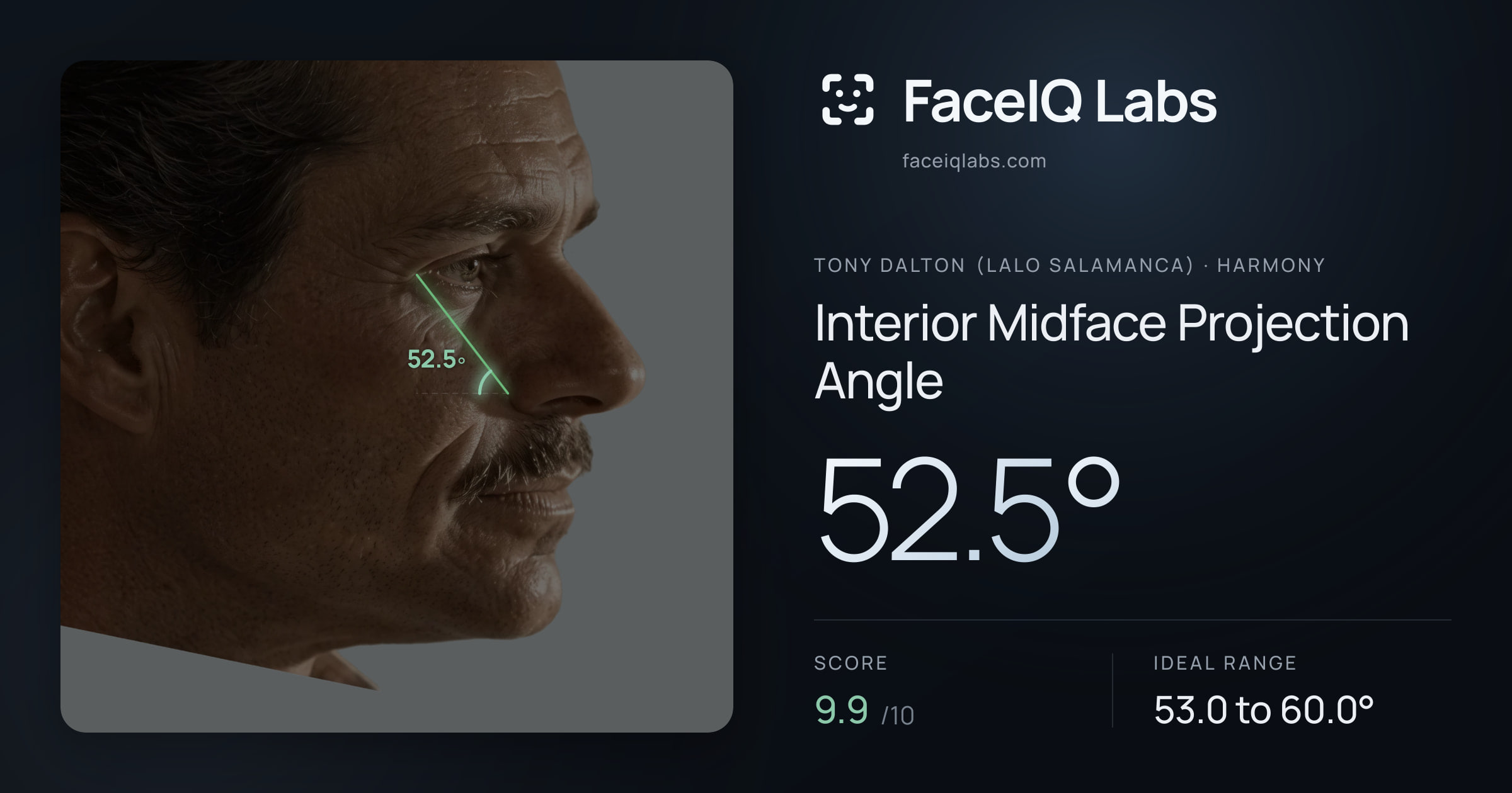Tony Dalton (Lalo Salamanca) Interior Midface Projection Angle: 52.5°, drawn on the photo