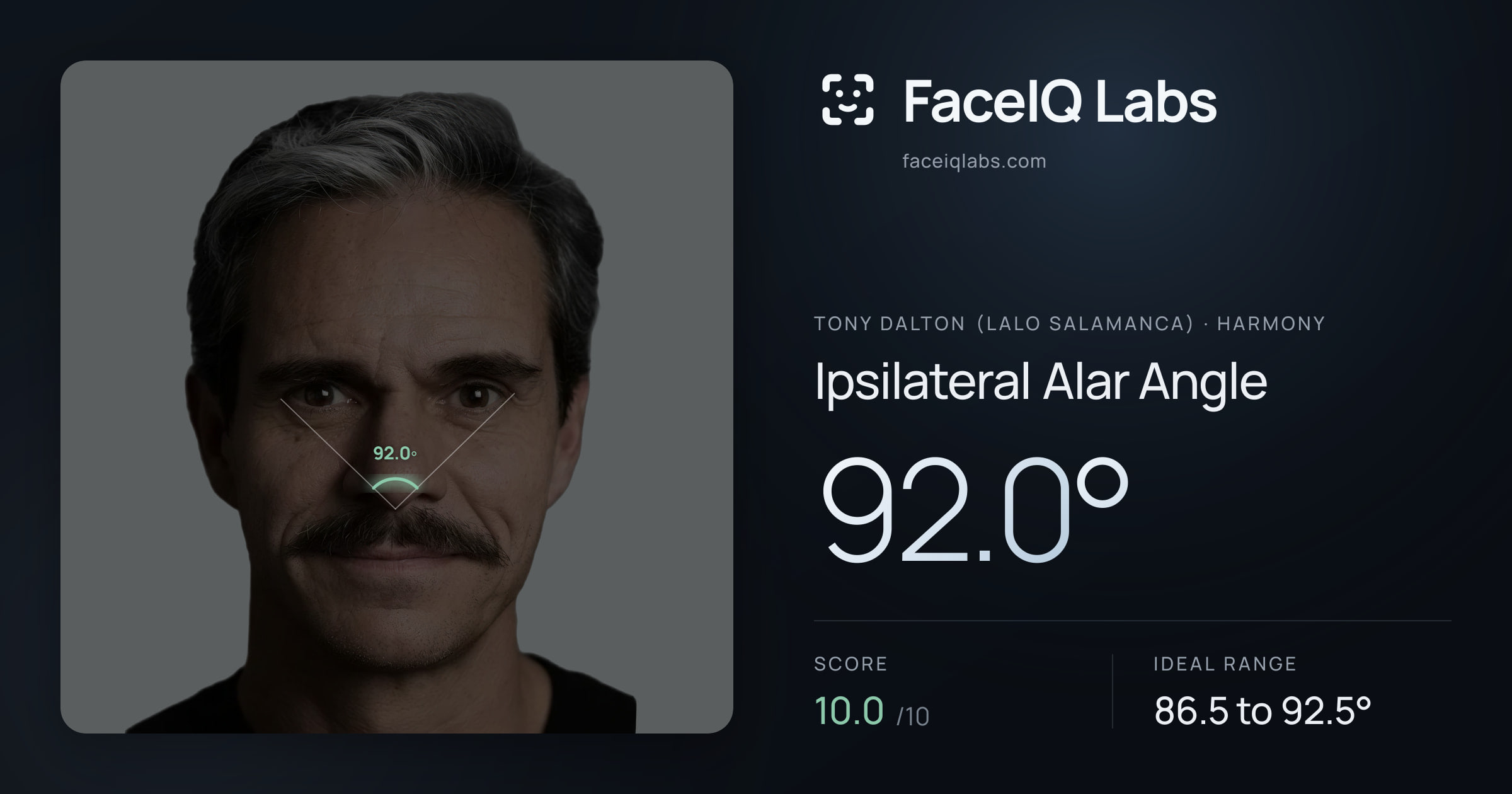 Tony Dalton (Lalo Salamanca) Ipsilateral Alar Angle: 92.0°, drawn on the photo