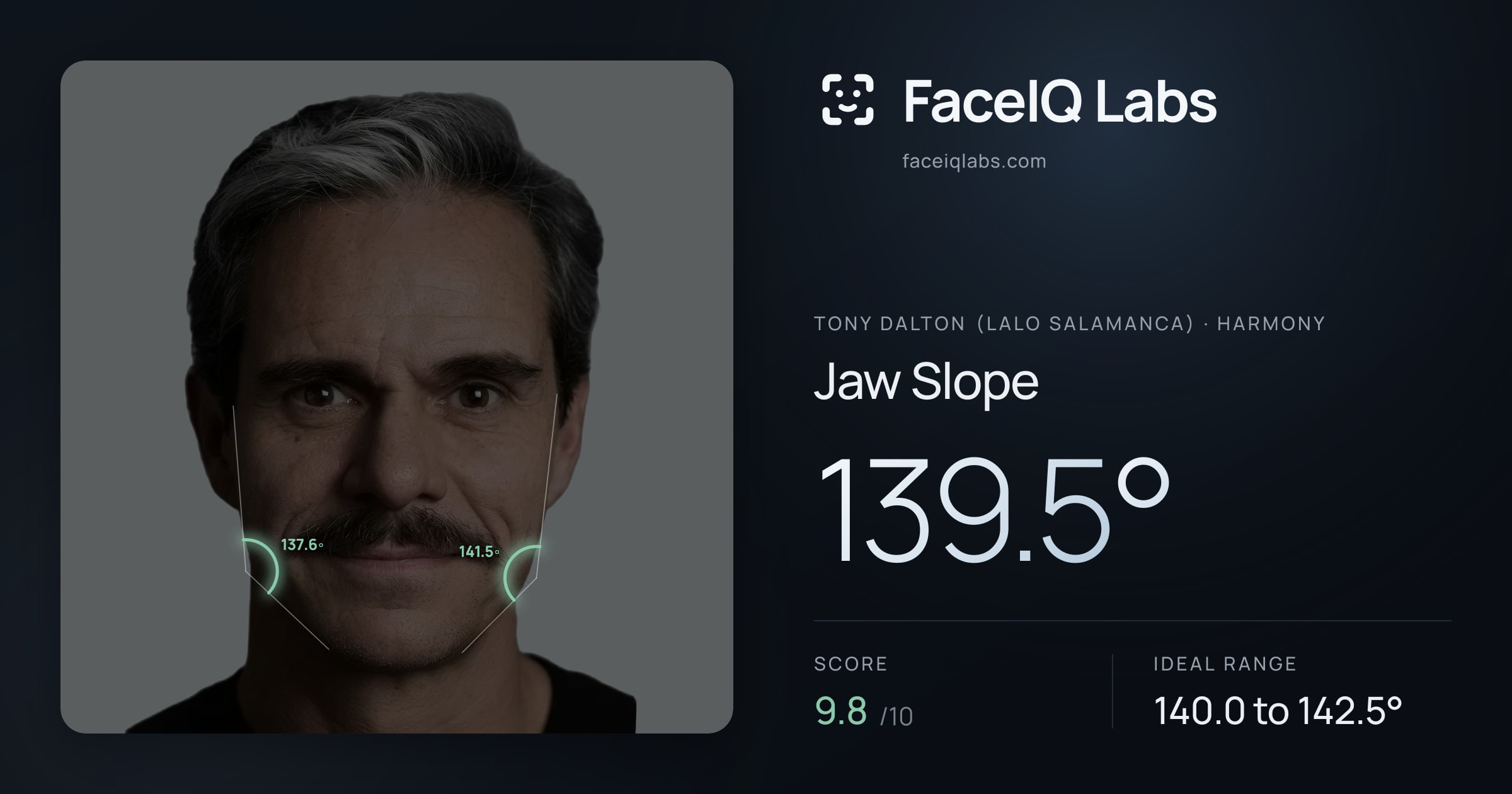 Tony Dalton (Lalo Salamanca) Jaw Slope: 139.5°, drawn on the photo
