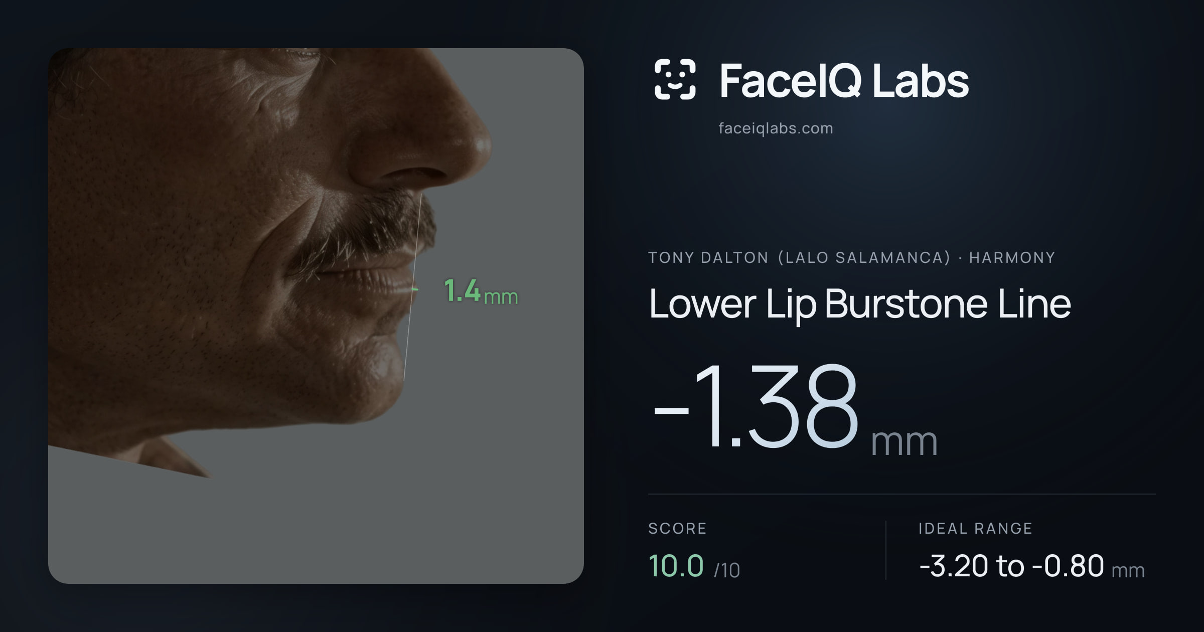 Tony Dalton (Lalo Salamanca) Lower Lip Burstone Line: -1.38mm, drawn on the photo