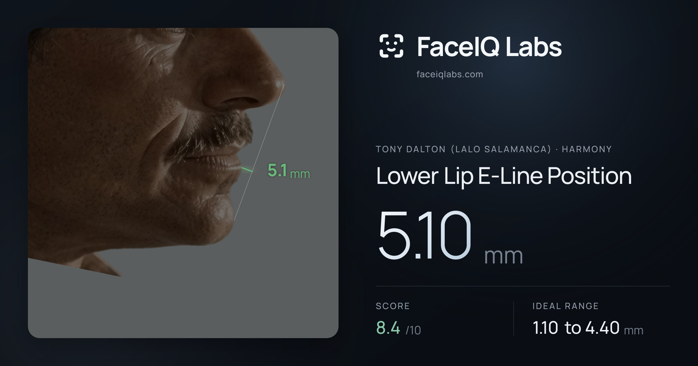 Tony Dalton (Lalo Salamanca) Lower Lip E-Line Position: 5.10mm, drawn on the photo
