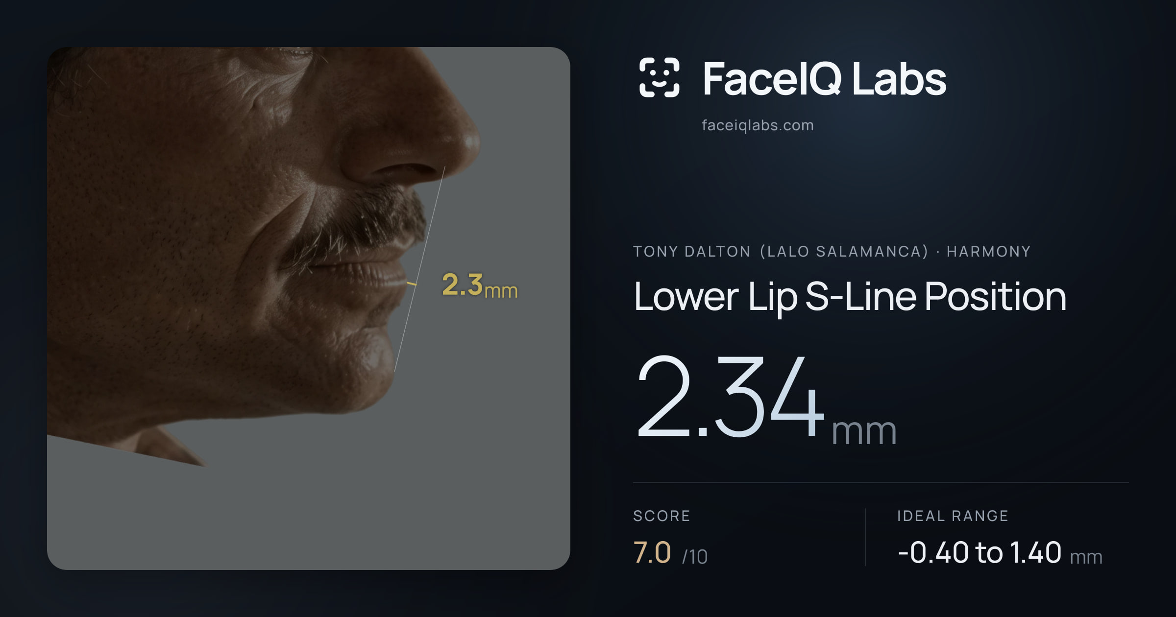 Tony Dalton (Lalo Salamanca) Lower Lip S-Line Position: 2.34mm, drawn on the photo