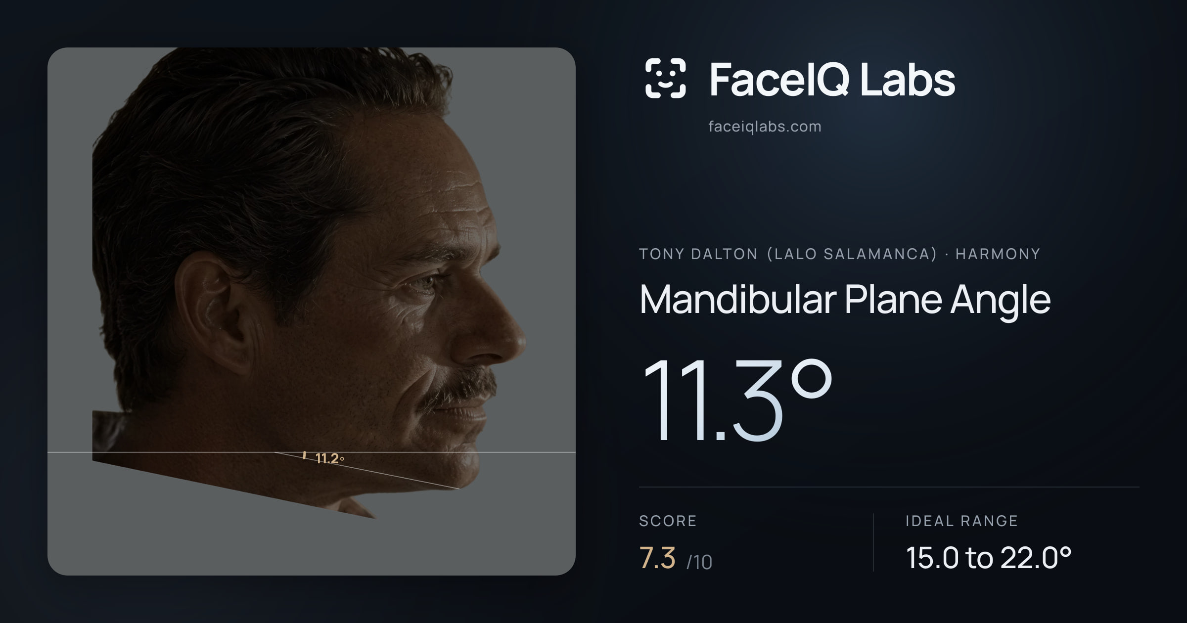 Tony Dalton (Lalo Salamanca) Mandibular Plane Angle: 11.3°, drawn on the photo