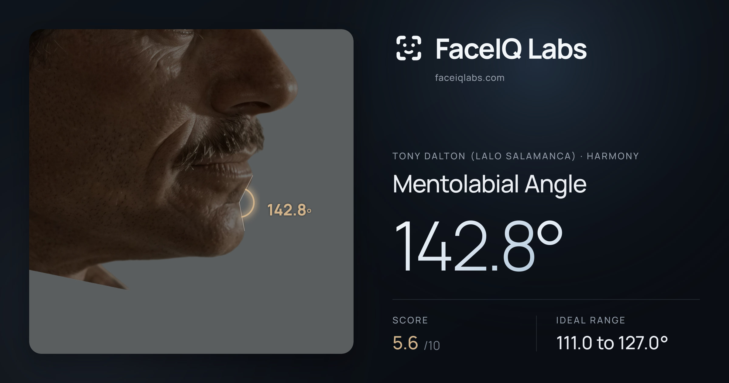 Tony Dalton (Lalo Salamanca) Mentolabial Angle: 142.8°, drawn on the photo