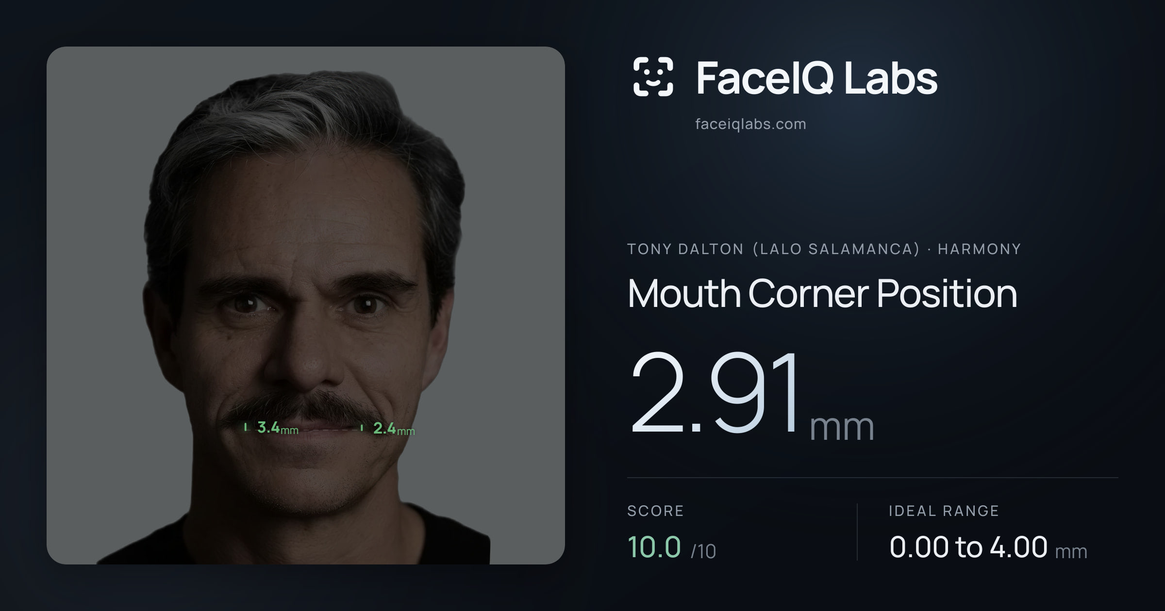 Tony Dalton (Lalo Salamanca) Mouth Corner Position: 2.91mm, drawn on the photo