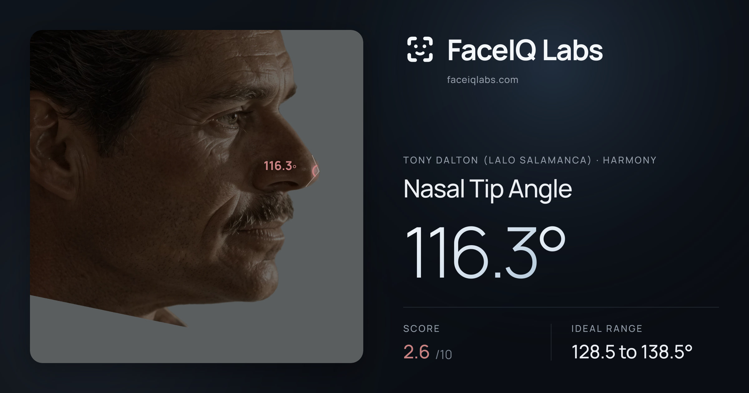Tony Dalton (Lalo Salamanca) Nasal Tip Angle: 116.3°, drawn on the photo
