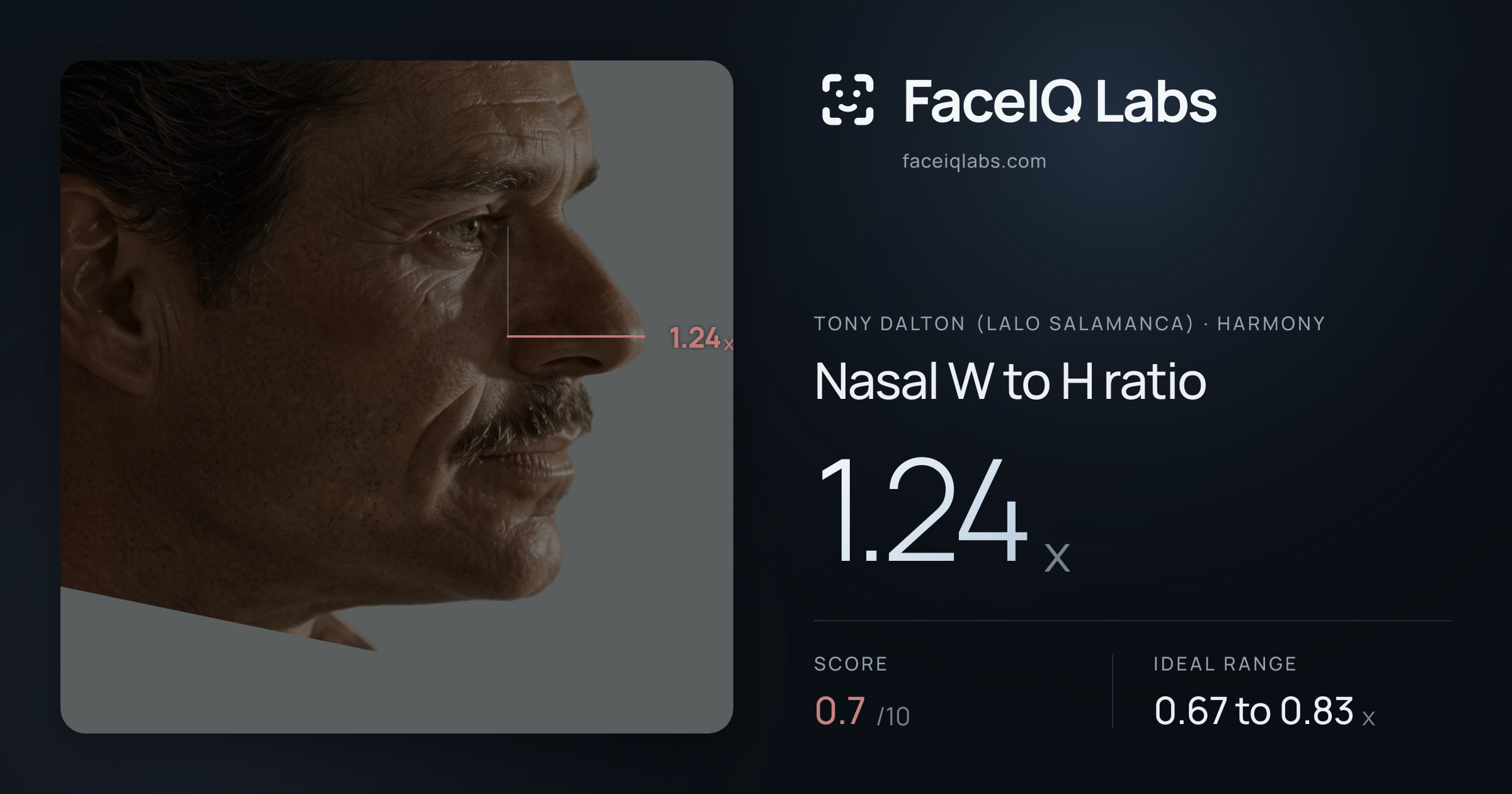 Tony Dalton (Lalo Salamanca) Nasal W to H ratio: 1.24x, drawn on the photo