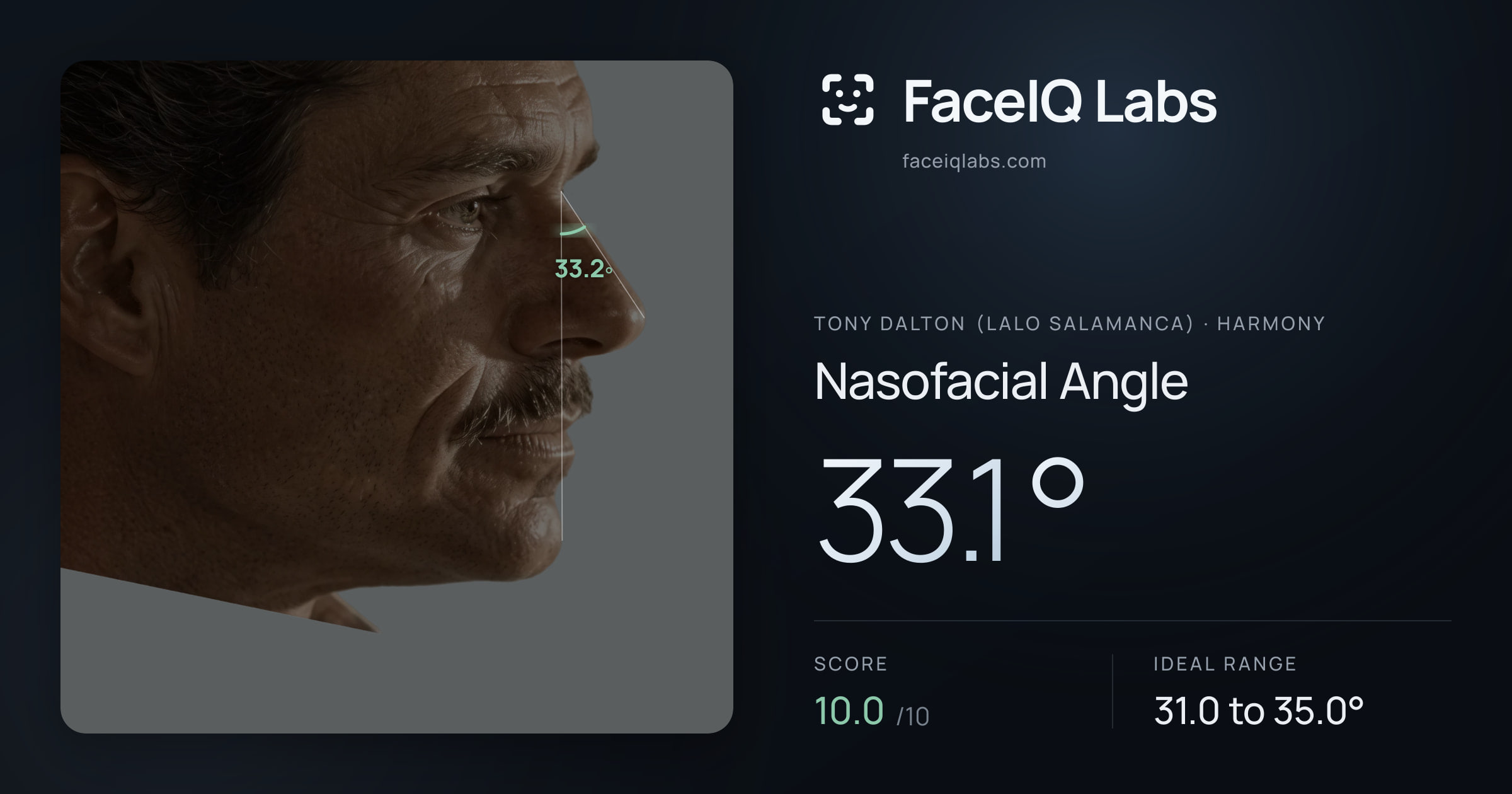 Tony Dalton (Lalo Salamanca) Nasofacial Angle: 33.1°, drawn on the photo