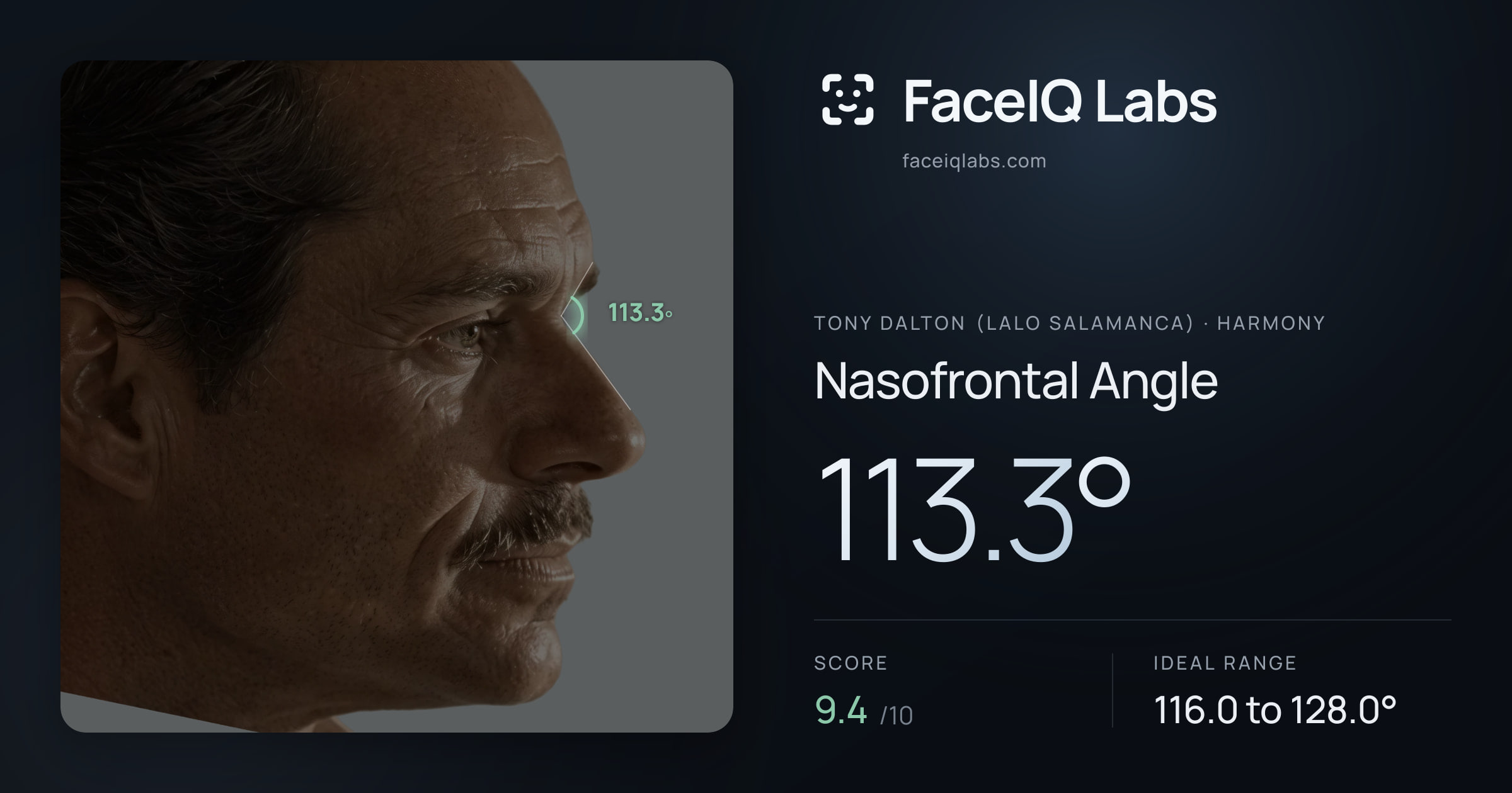 Tony Dalton (Lalo Salamanca) Nasofrontal Angle: 113.3°, drawn on the photo