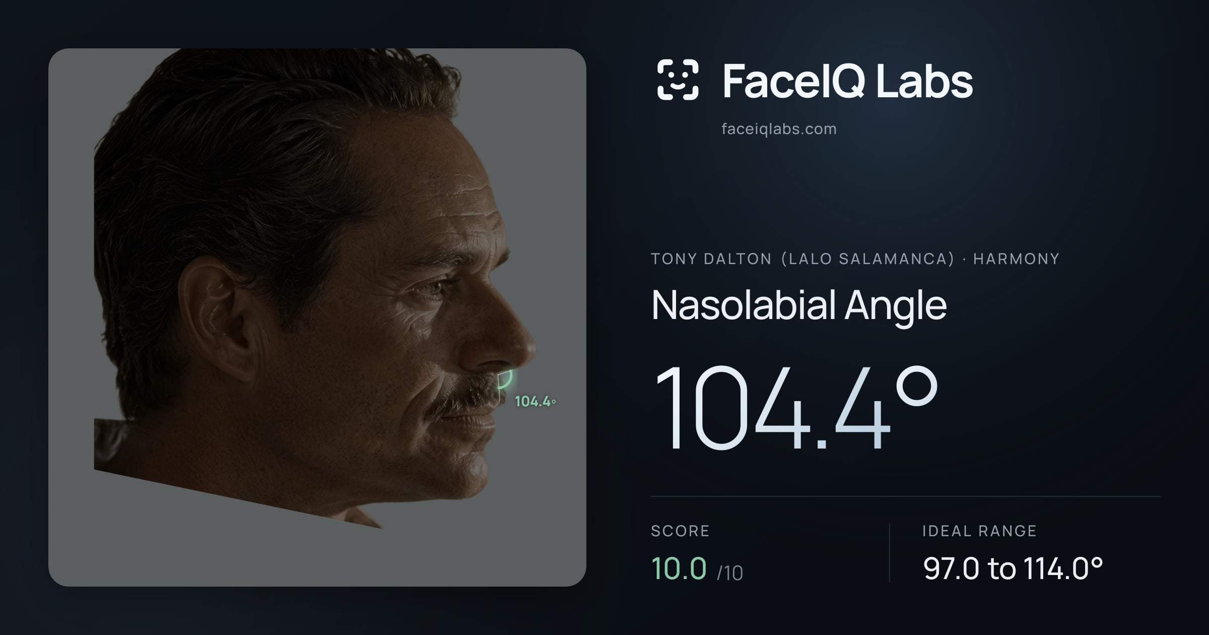 Tony Dalton (Lalo Salamanca) Nasolabial Angle: 104.4°, drawn on the photo